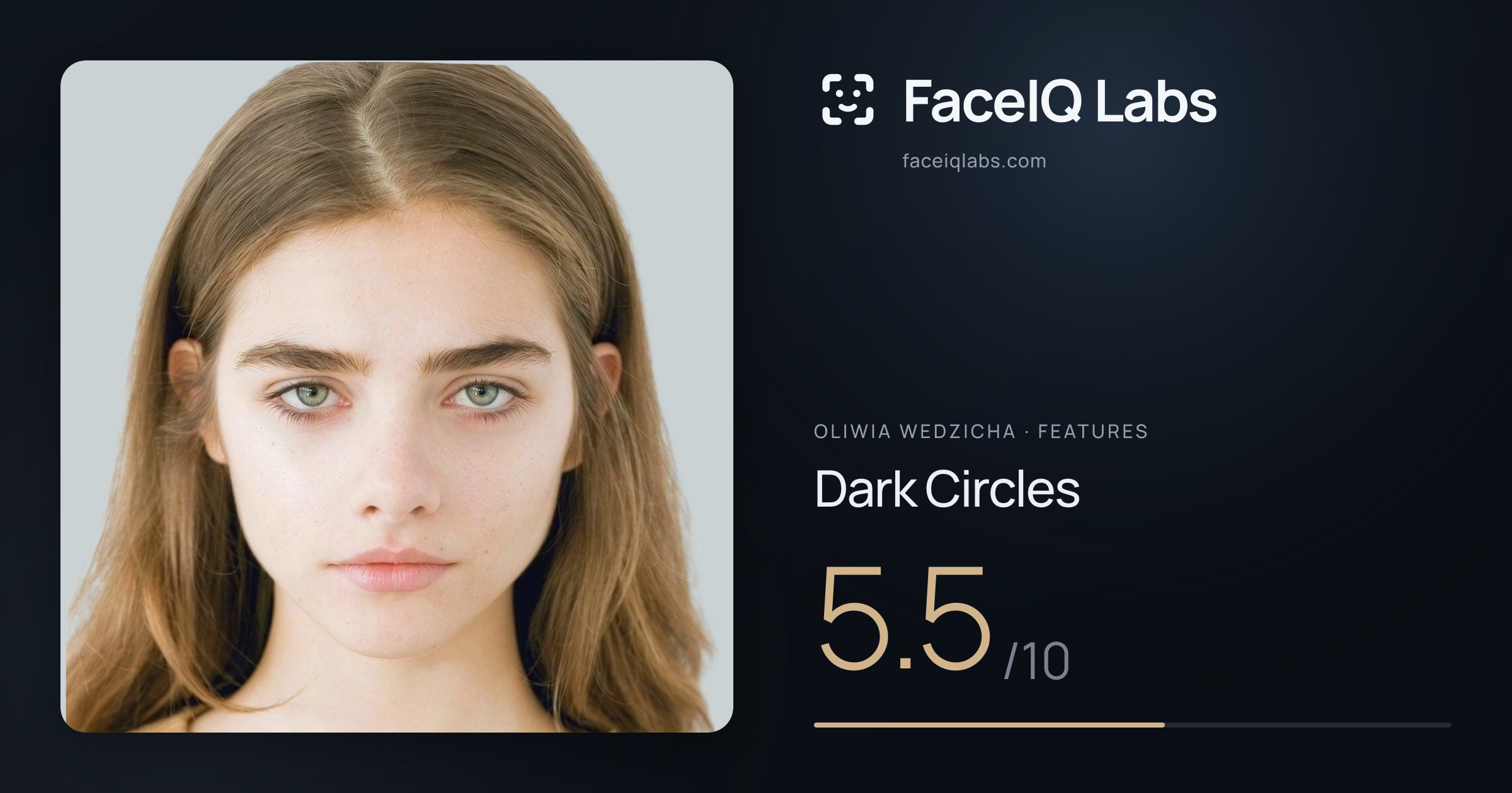 Oliwia Wedzicha Dark Circles: 5.5/10, drawn on the photo