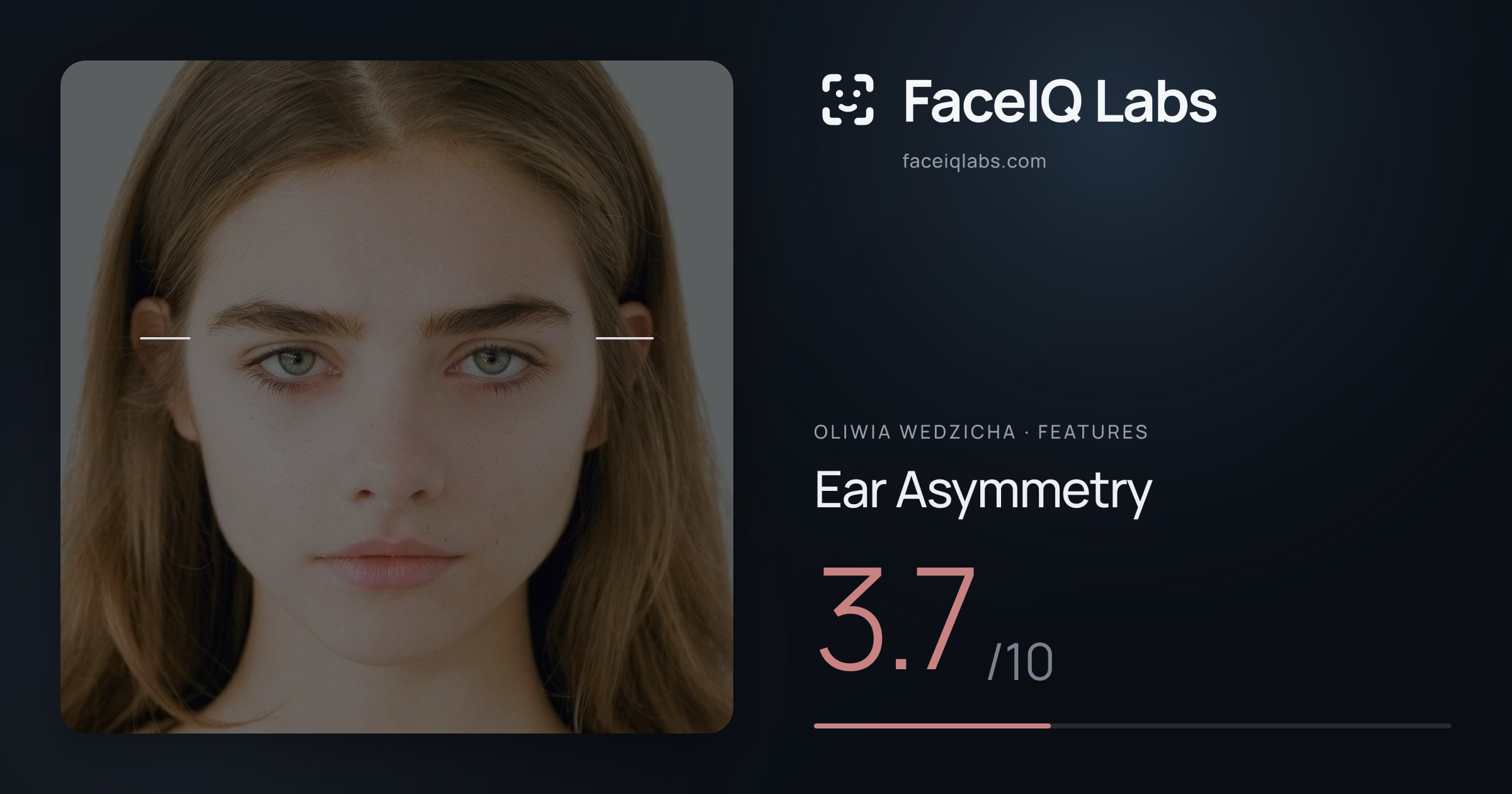 Oliwia Wedzicha Ear Asymmetry: 3.7/10, drawn on the photo