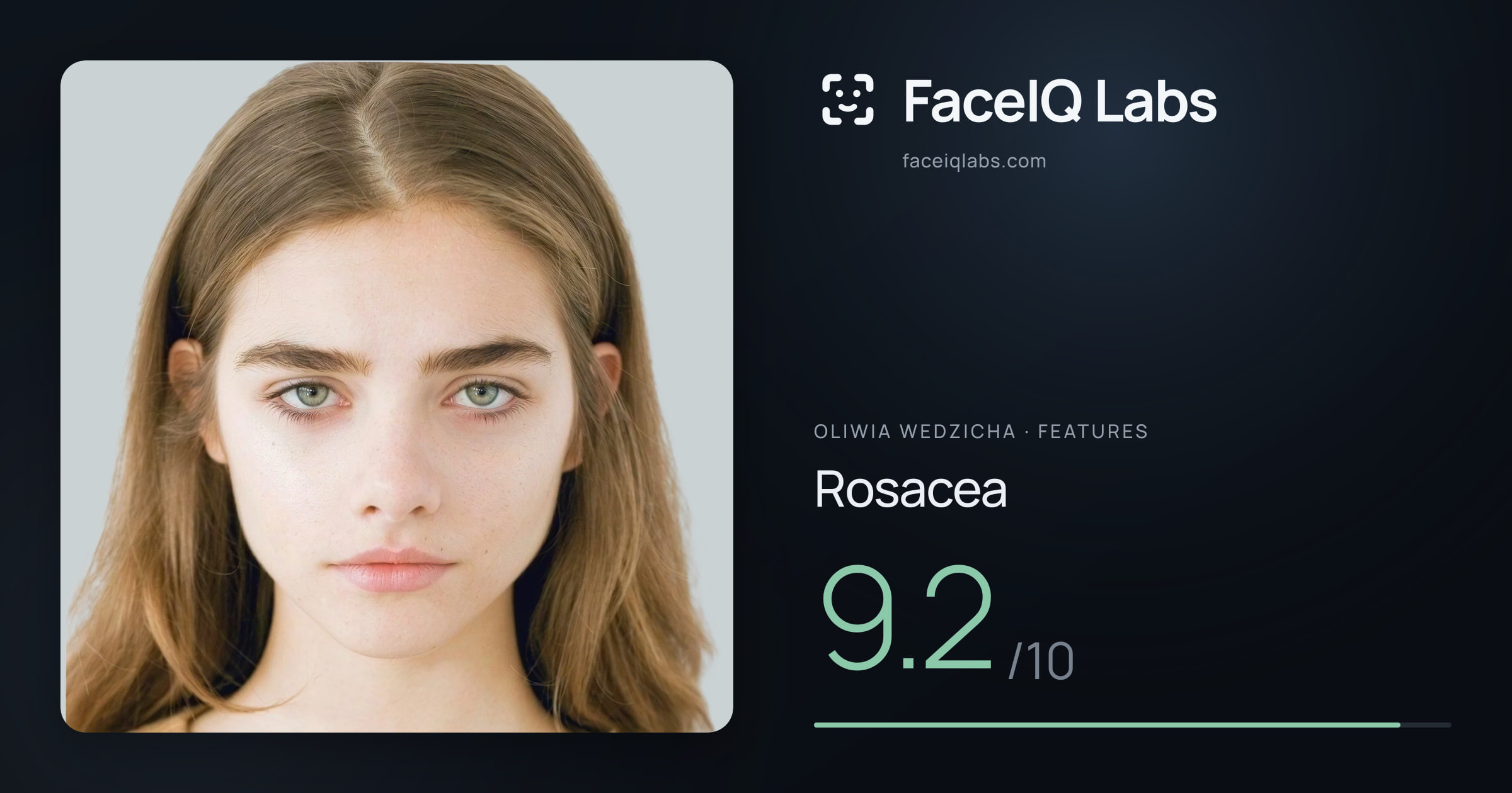 Oliwia Wedzicha Rosacea: 9.2/10, drawn on the photo