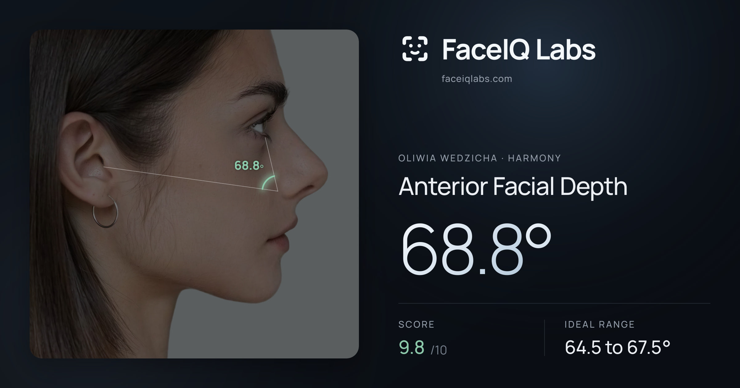 Oliwia Wedzicha Anterior Facial Depth: 68.8°, drawn on the photo