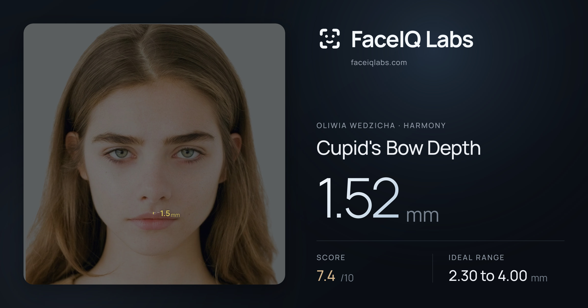 Oliwia Wedzicha Cupid's Bow Depth: 1.52mm, drawn on the photo