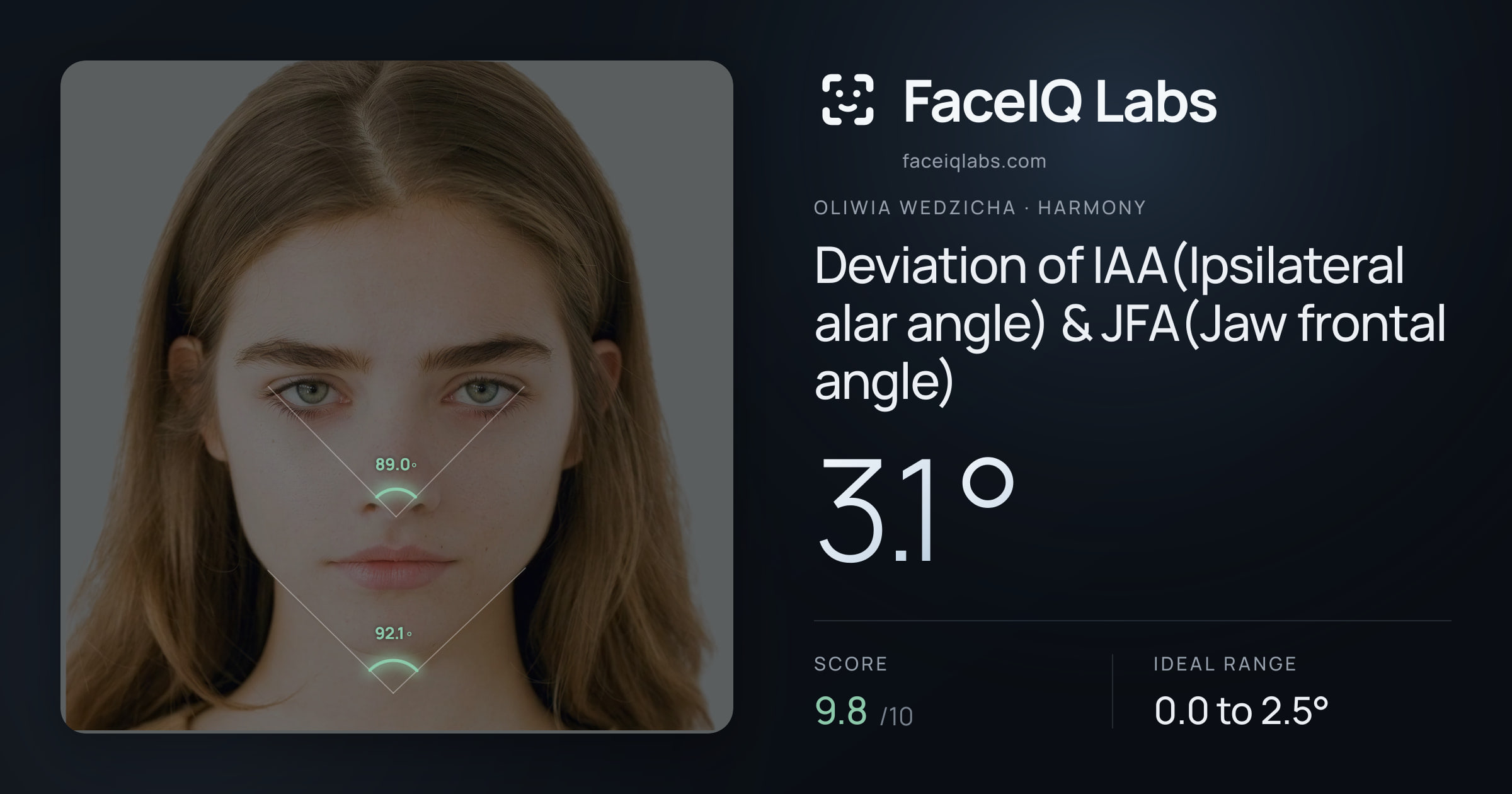 Oliwia Wedzicha Deviation of IAA(Ipsilateral alar angle) & JFA(Jaw frontal angle): 3.1°, drawn on the photo