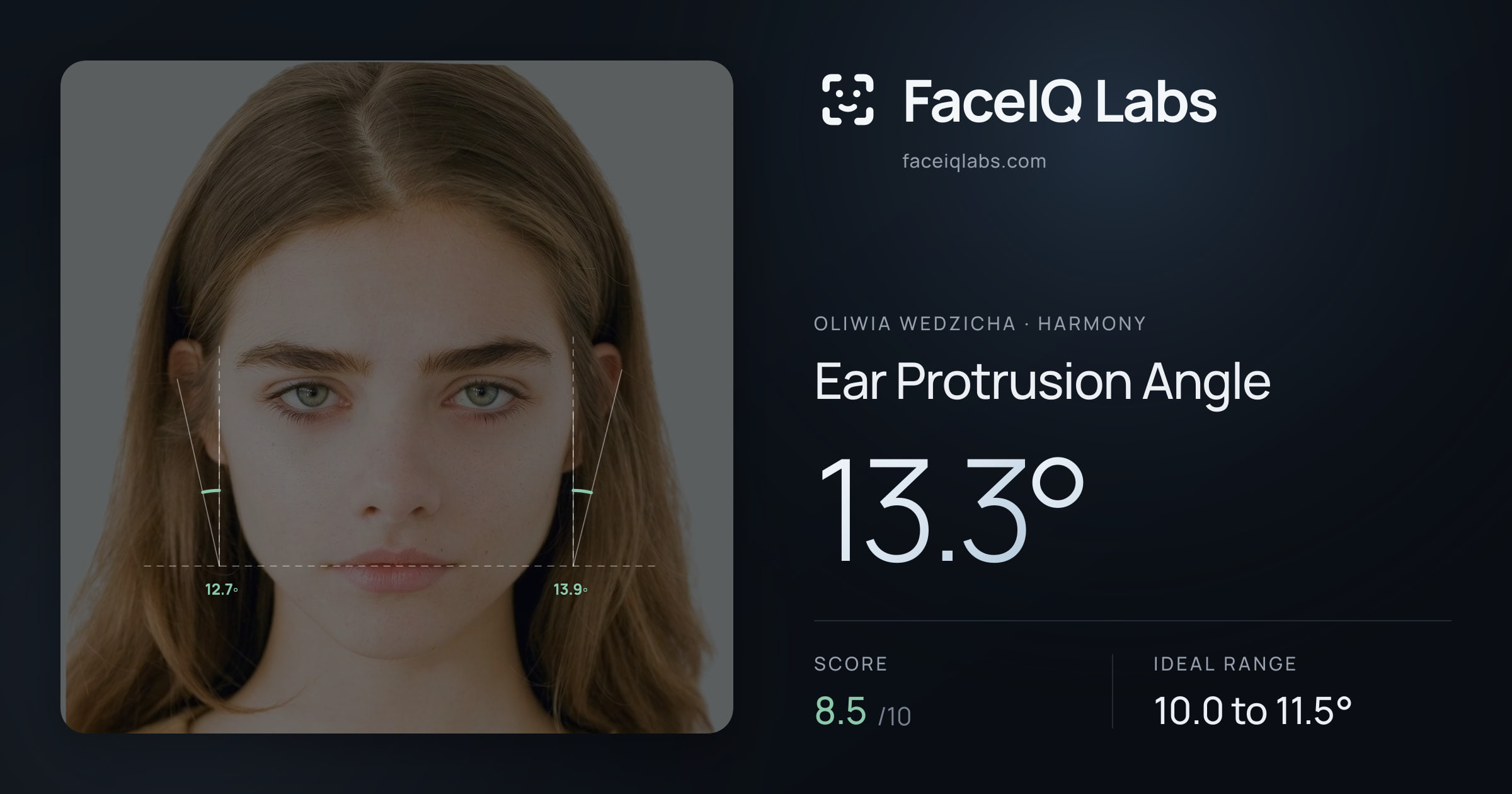Oliwia Wedzicha Ear Protrusion Angle: 13.3°, drawn on the photo