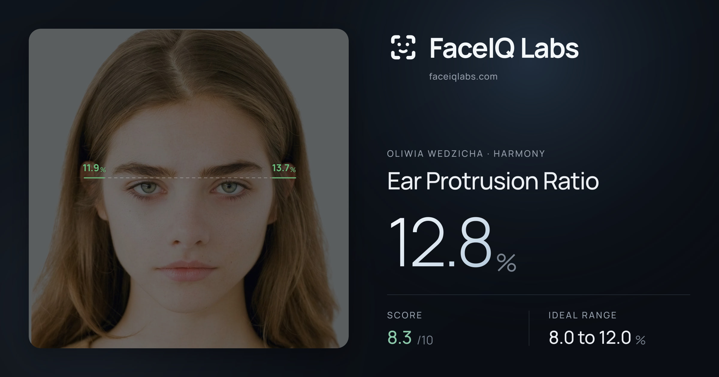 Oliwia Wedzicha Ear Protrusion Ratio: 12.8%, drawn on the photo