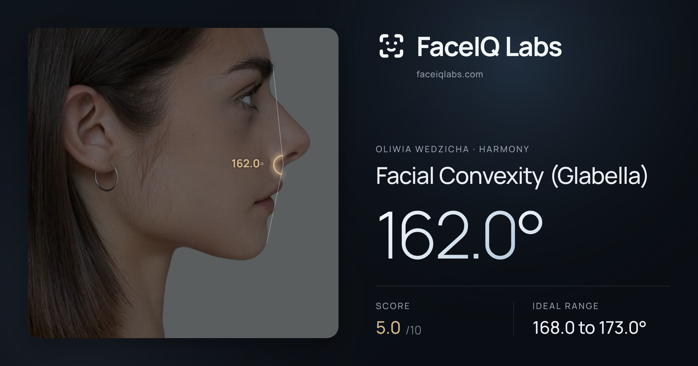 Oliwia Wedzicha Facial Convexity (Glabella): 162.0°, drawn on the photo