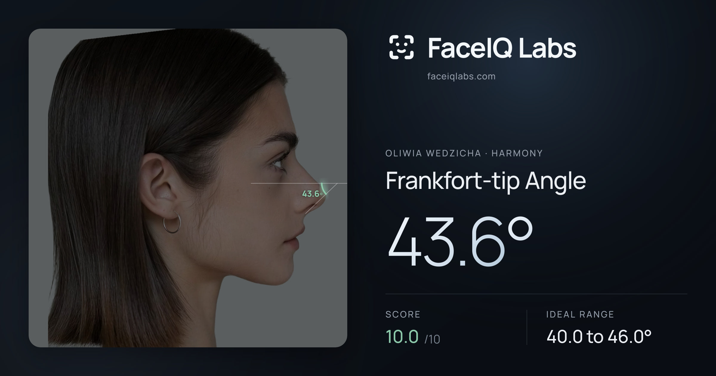 Oliwia Wedzicha Frankfort-tip Angle: 43.6°, drawn on the photo