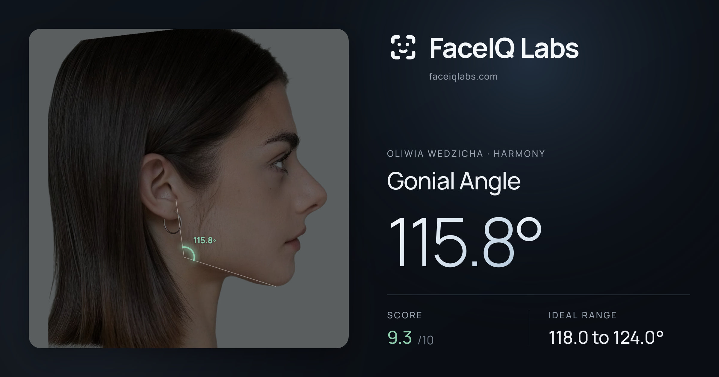 Oliwia Wedzicha Gonial Angle: 115.8°, drawn on the photo