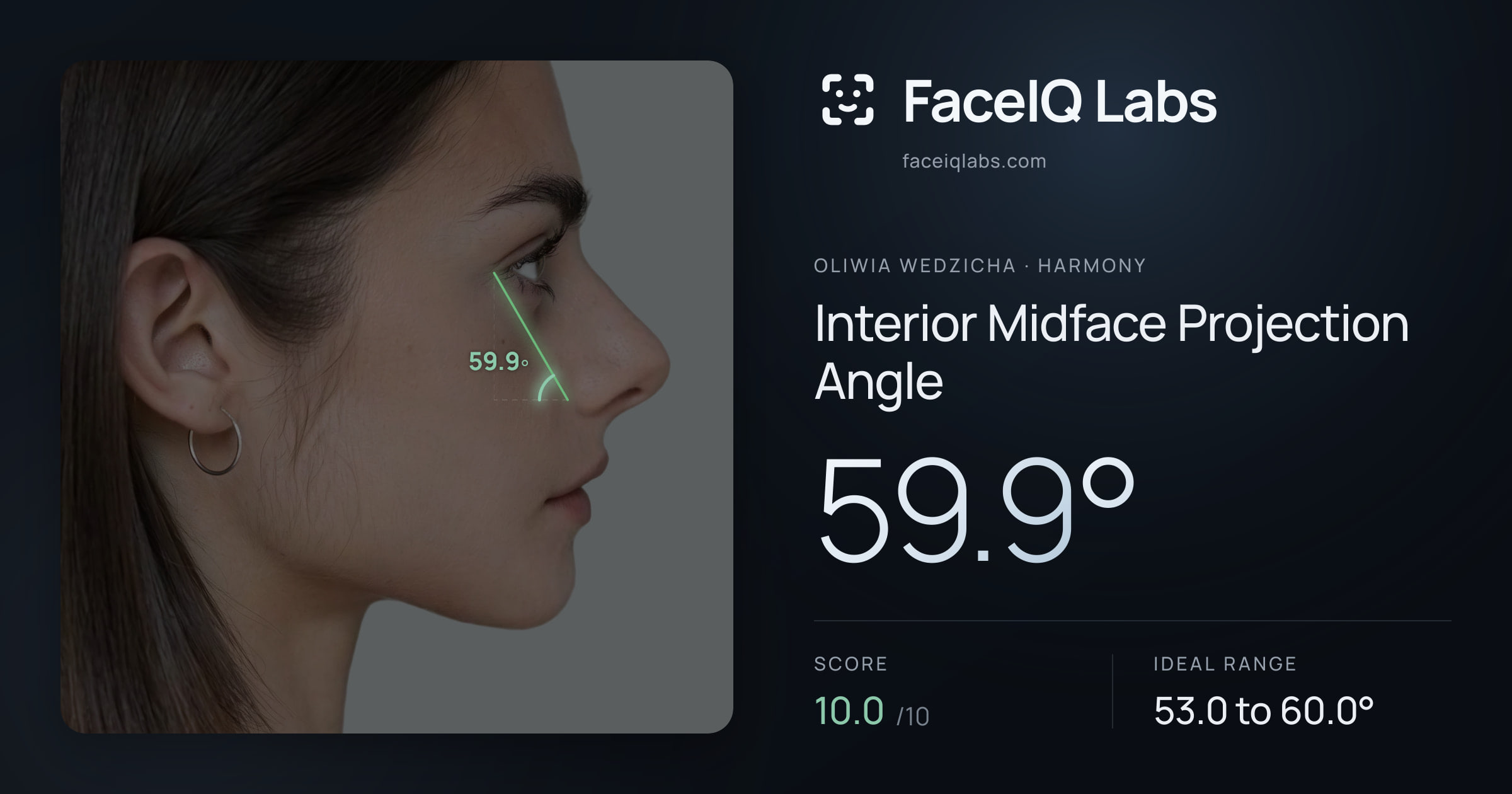 Oliwia Wedzicha Interior Midface Projection Angle: 59.9°, drawn on the photo