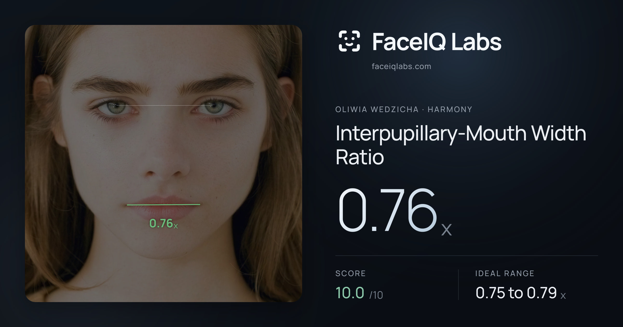 Oliwia Wedzicha Interpupillary-Mouth Width Ratio: 0.76x, drawn on the photo
