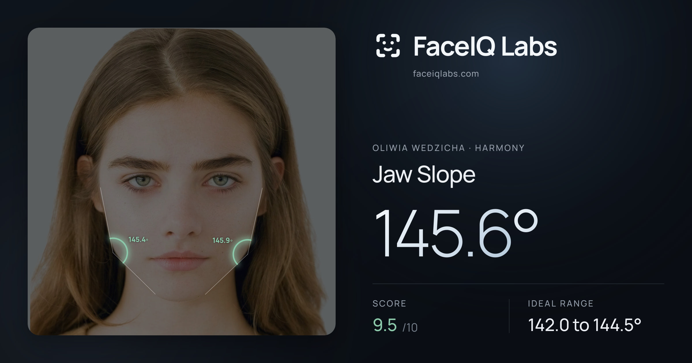 Oliwia Wedzicha Jaw Slope: 145.6°, drawn on the photo