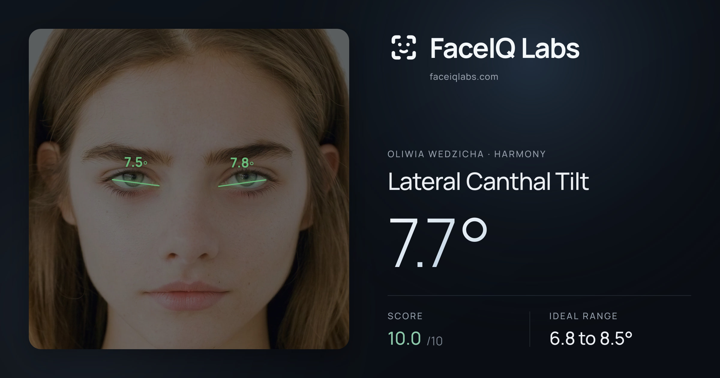 Oliwia Wedzicha Lateral Canthal Tilt: 7.7°, drawn on the photo