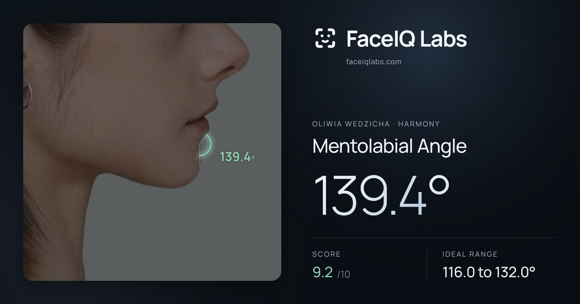 Oliwia Wedzicha Mentolabial Angle: 139.4°, drawn on the photo