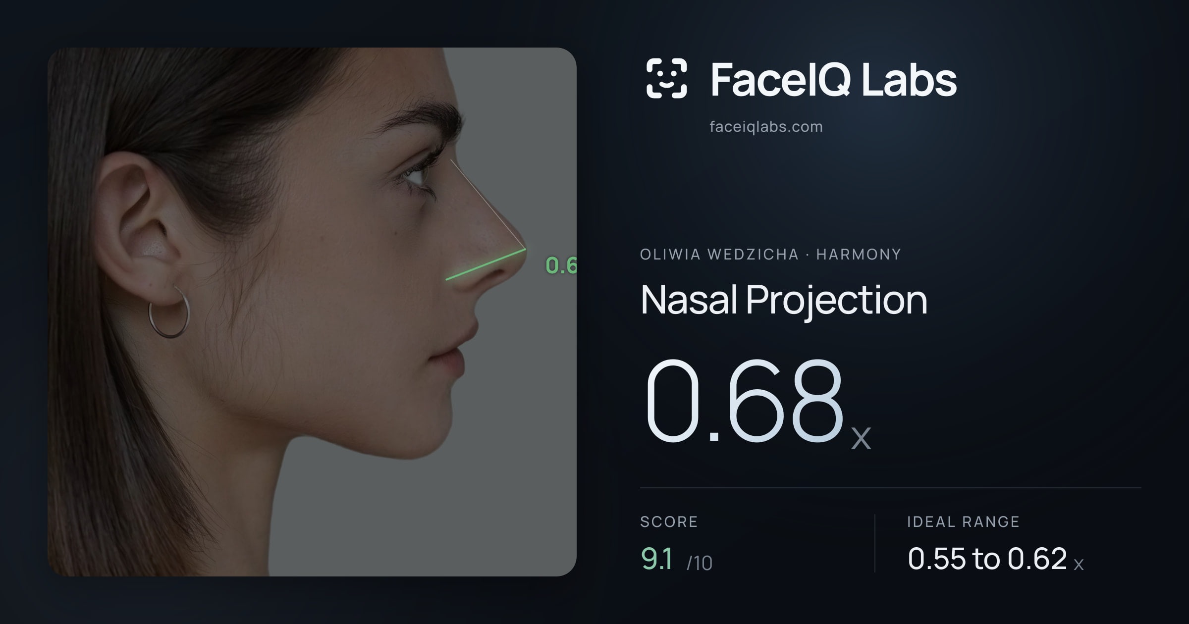 Oliwia Wedzicha Nasal Projection: 0.68x, drawn on the photo
