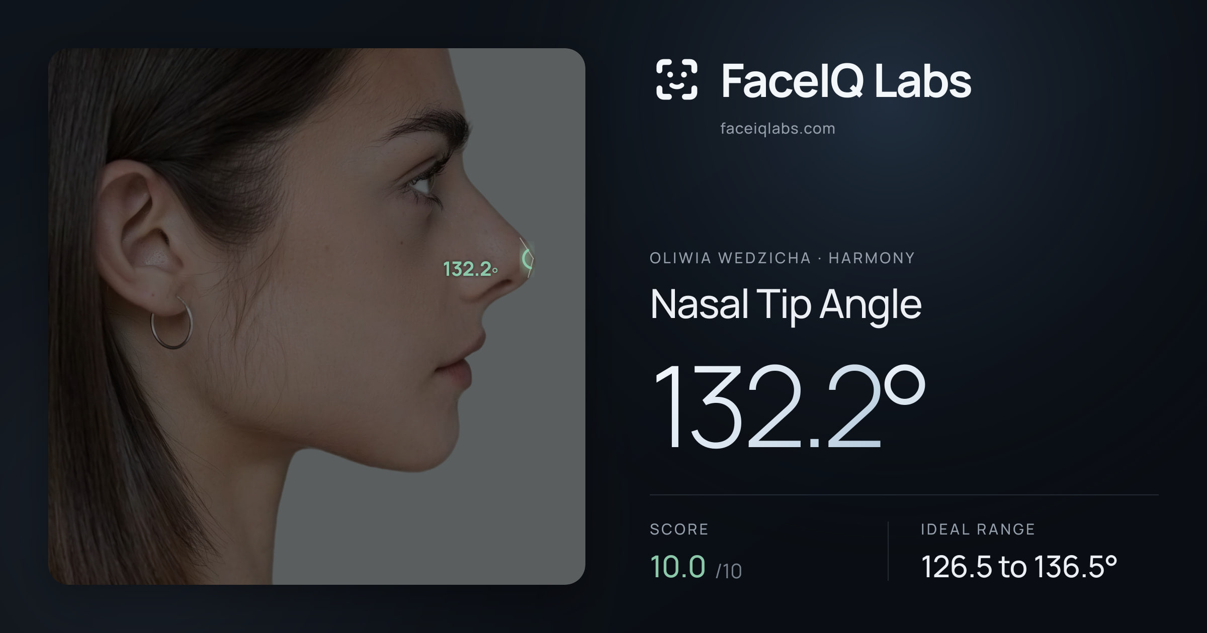 Oliwia Wedzicha Nasal Tip Angle: 132.2°, drawn on the photo