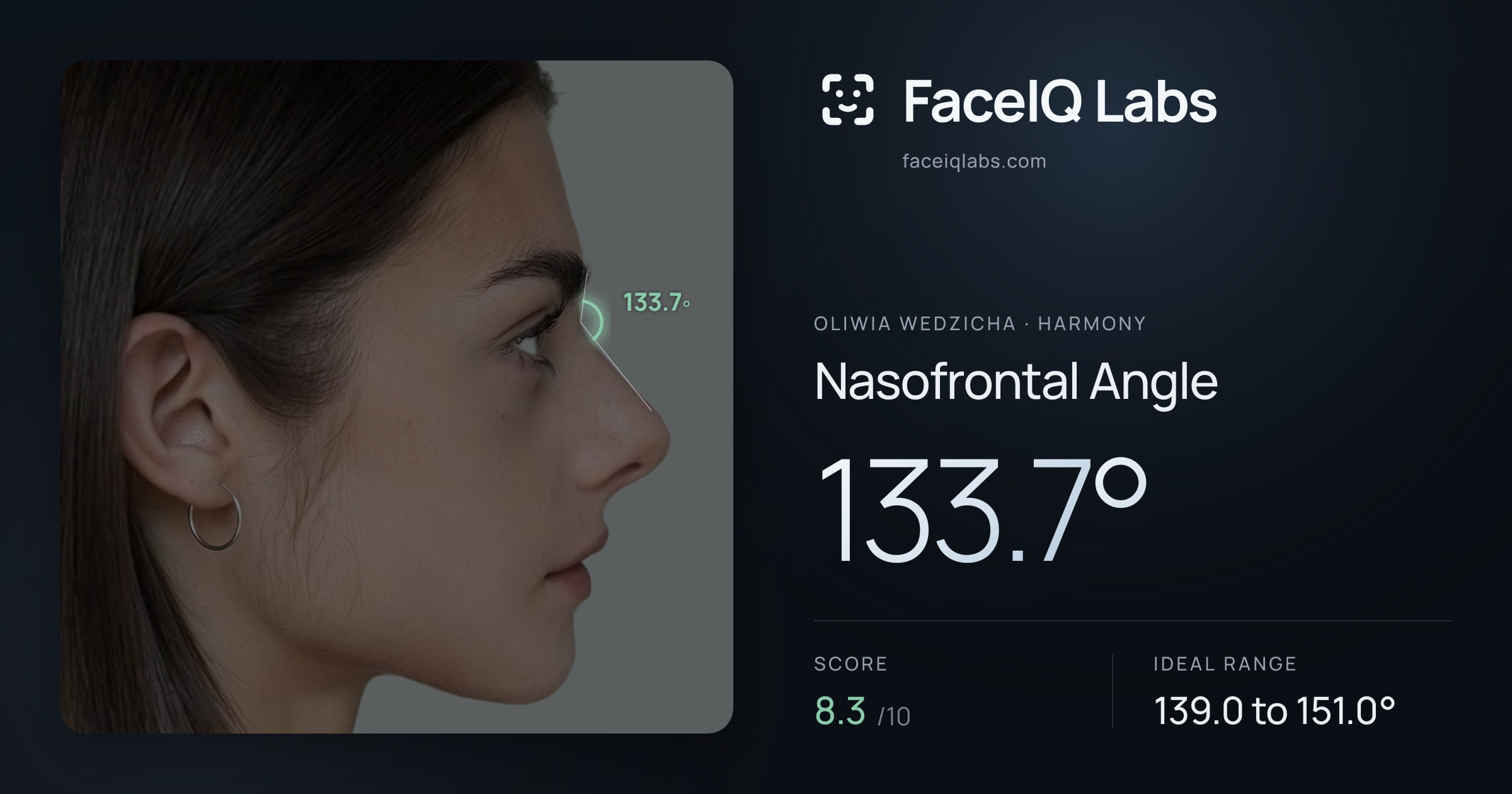 Oliwia Wedzicha Nasofrontal Angle: 133.7°, drawn on the photo