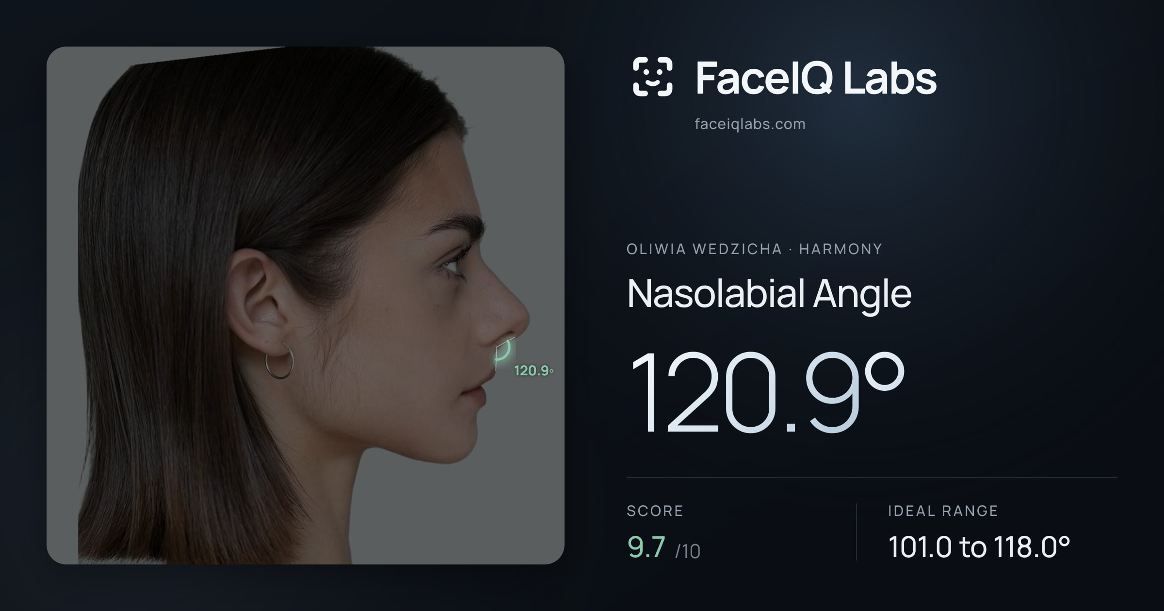 Oliwia Wedzicha Nasolabial Angle: 120.9°, drawn on the photo