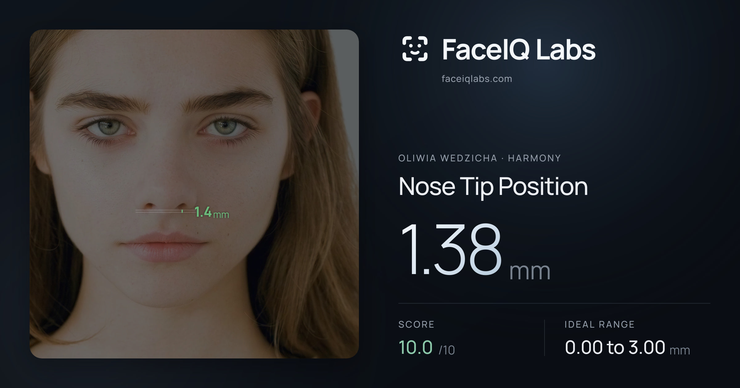 Oliwia Wedzicha Nose Tip Position: 1.38mm, drawn on the photo