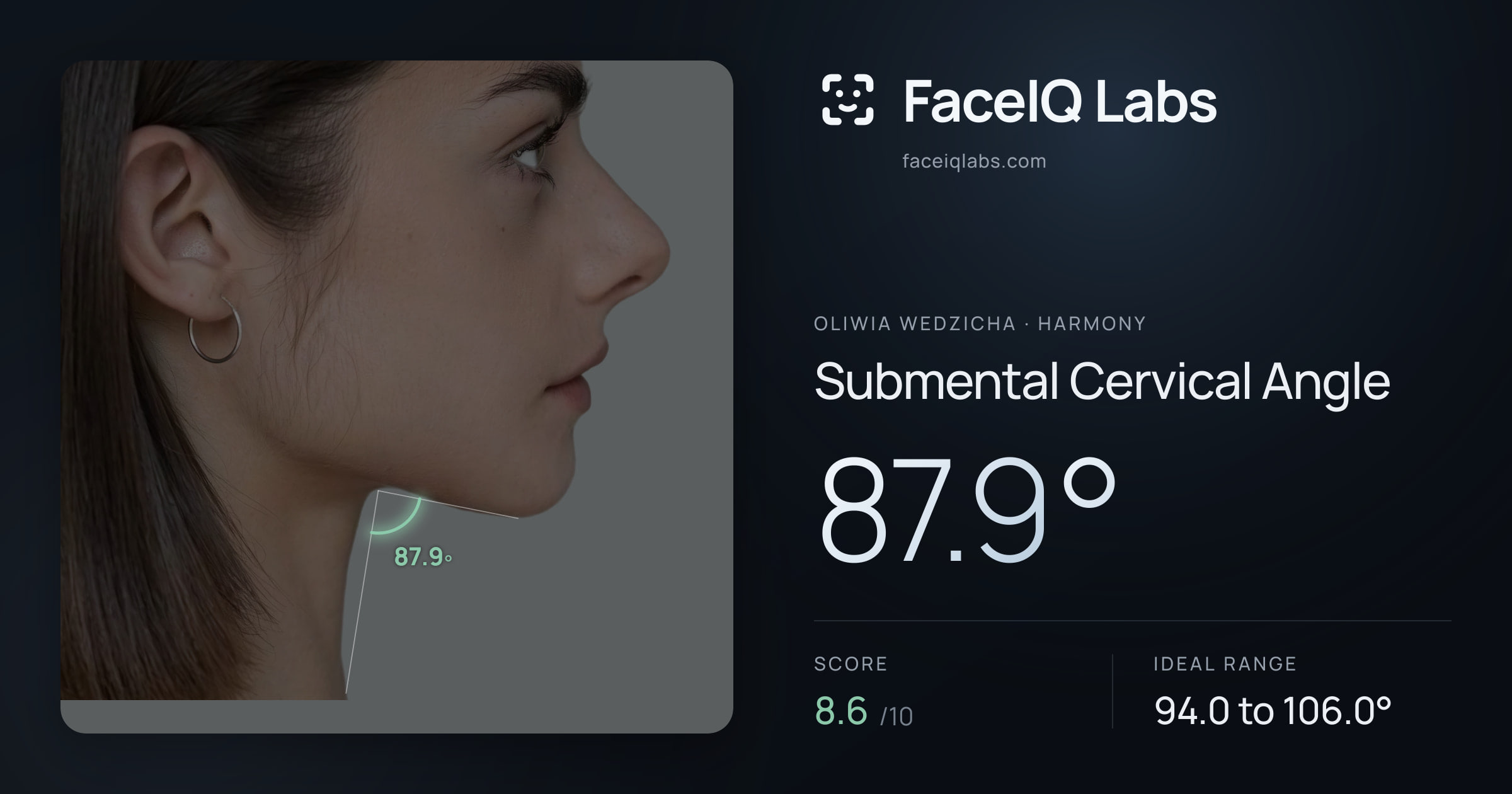 Oliwia Wedzicha Submental Cervical Angle: 87.9°, drawn on the photo