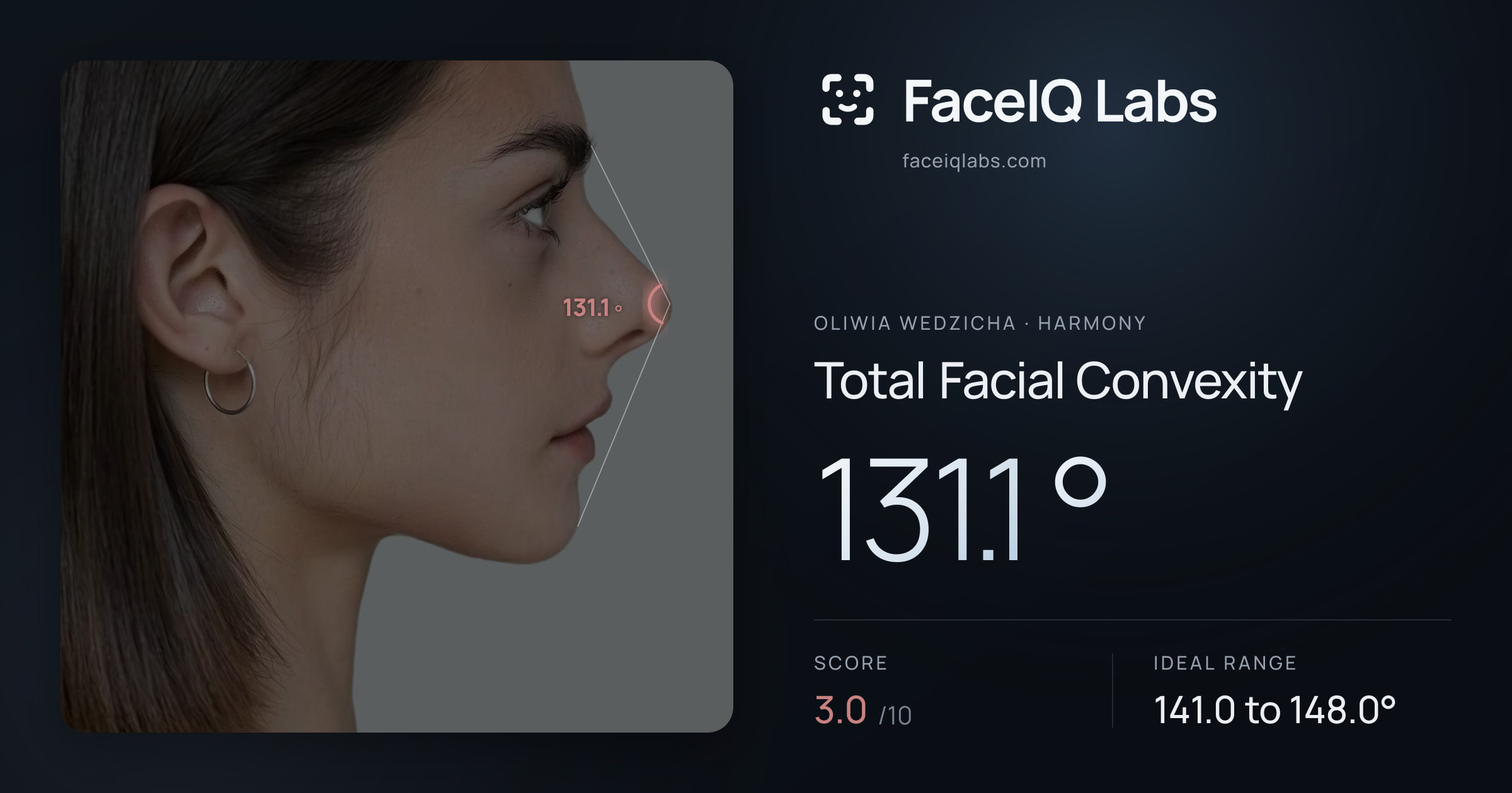 Oliwia Wedzicha Total Facial Convexity: 131.1°, drawn on the photo