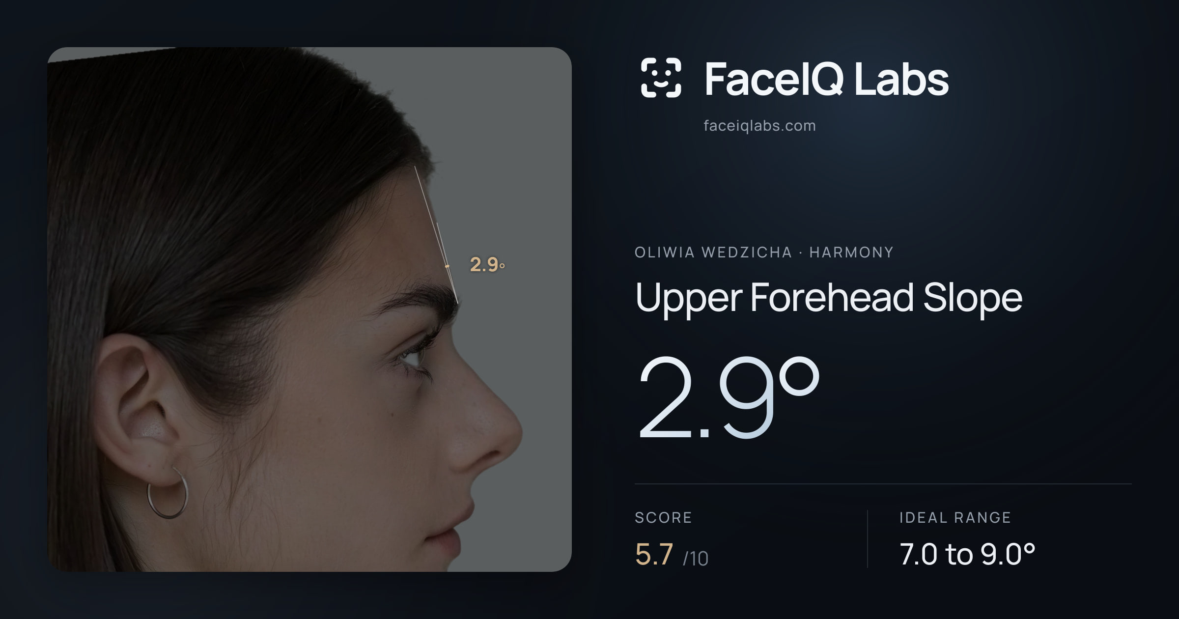 Oliwia Wedzicha Upper Forehead Slope: 2.9°, drawn on the photo