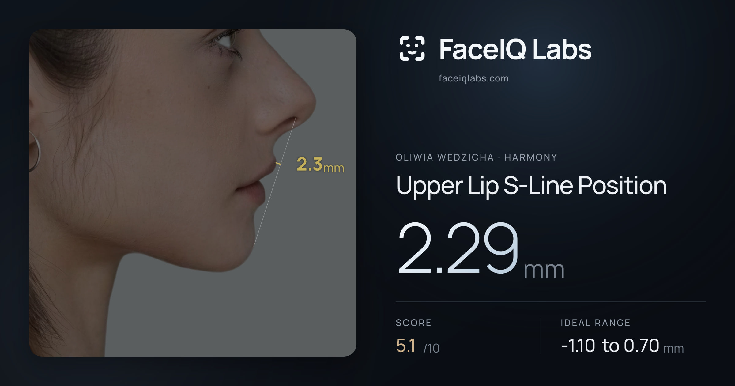 Oliwia Wedzicha Upper Lip S-Line Position: 2.29mm, drawn on the photo