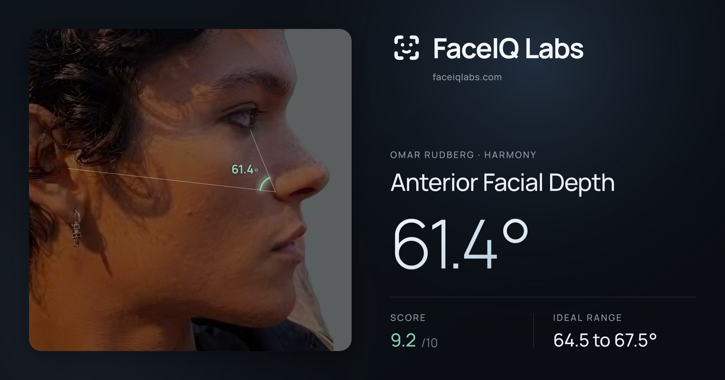 Omar Rudberg Anterior Facial Depth: 61.4°, drawn on the photo