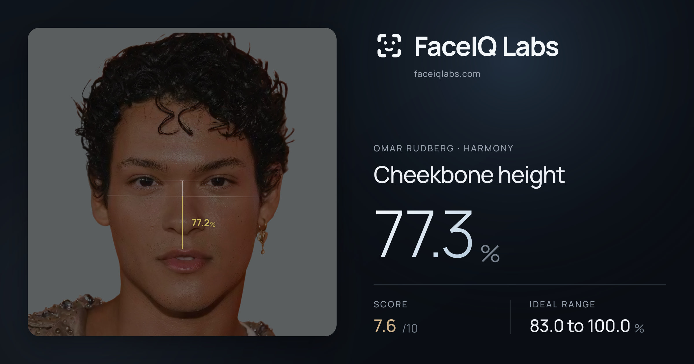 Omar Rudberg Cheekbone height: 77.3%, drawn on the photo