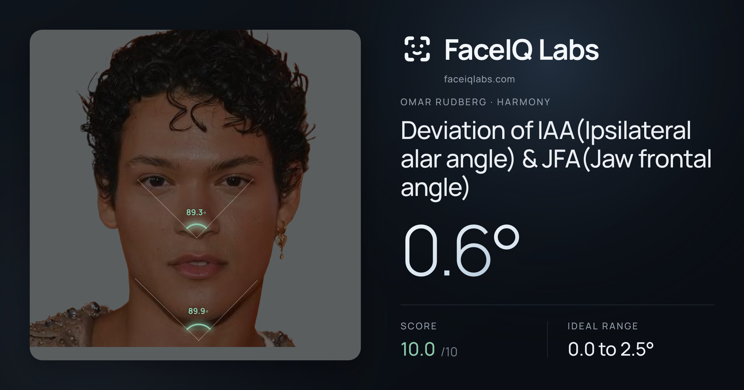 Omar Rudberg Deviation of IAA(Ipsilateral alar angle) & JFA(Jaw frontal angle): 0.6°, drawn on the photo