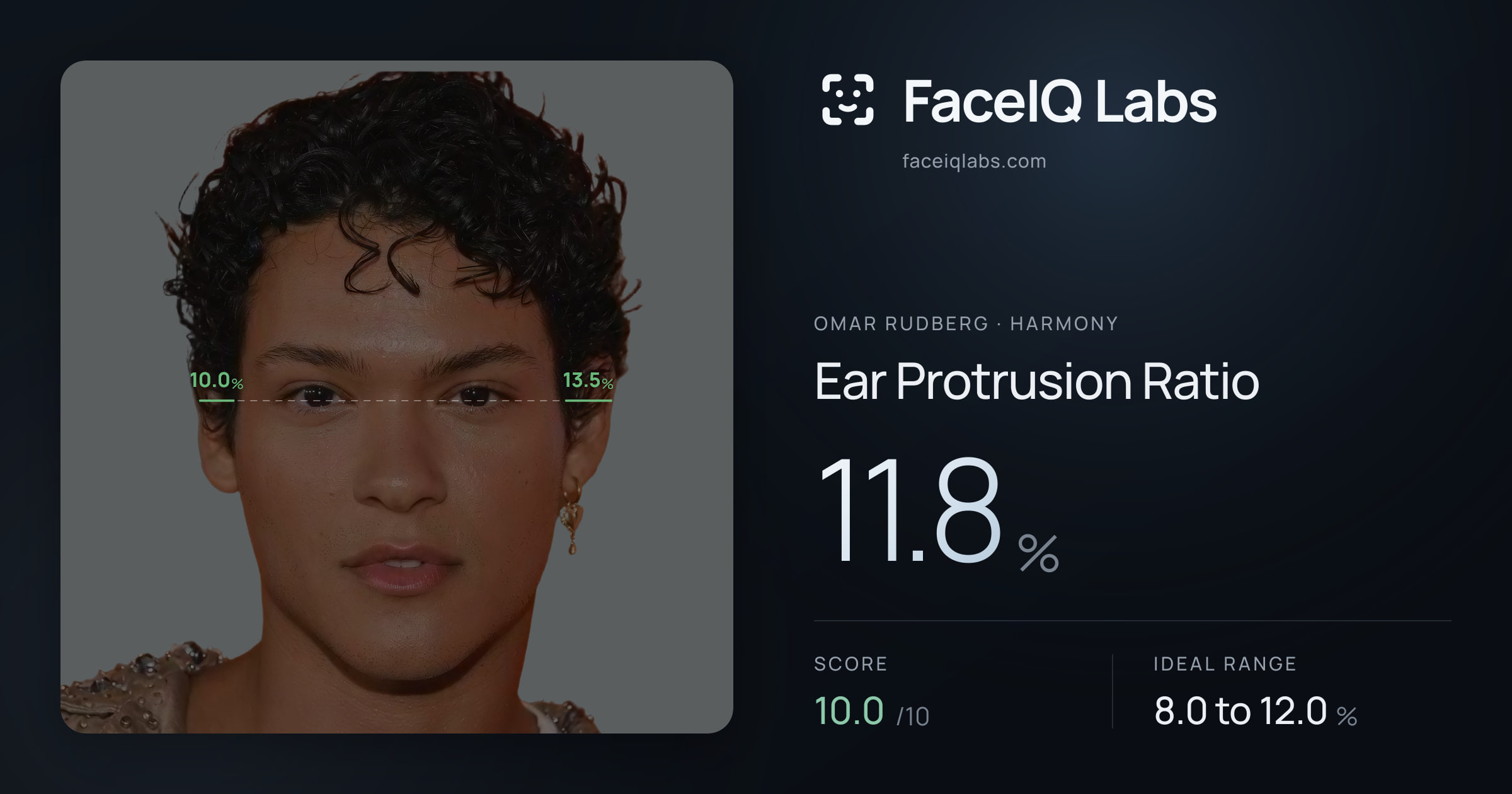 Omar Rudberg Ear Protrusion Ratio: 11.8%, drawn on the photo