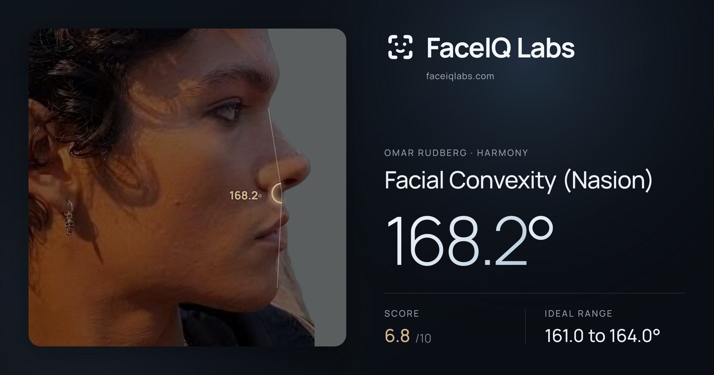 Omar Rudberg Facial Convexity (Nasion): 168.2°, drawn on the photo