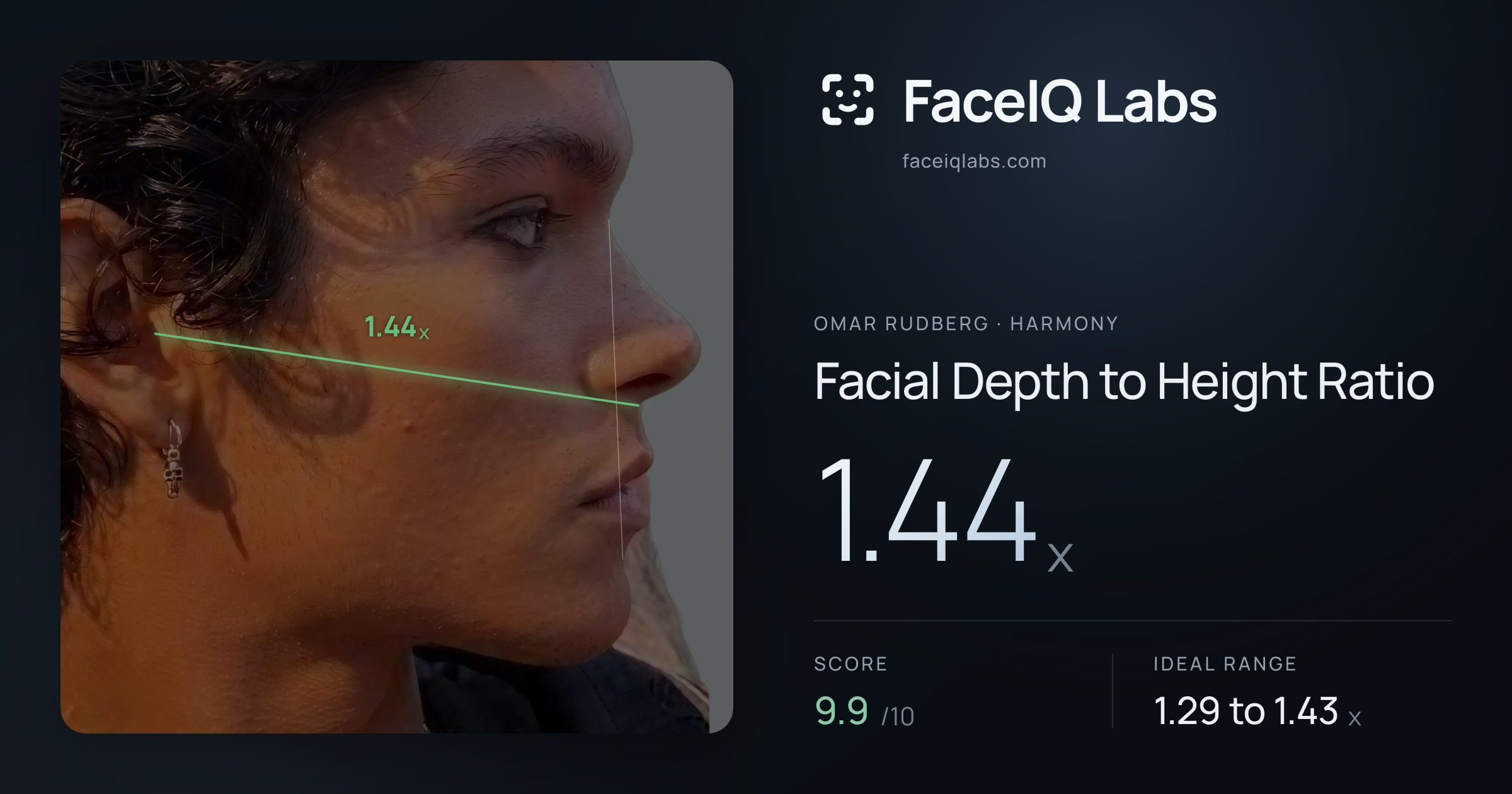 Omar Rudberg Facial Depth to Height Ratio: 1.44x, drawn on the photo