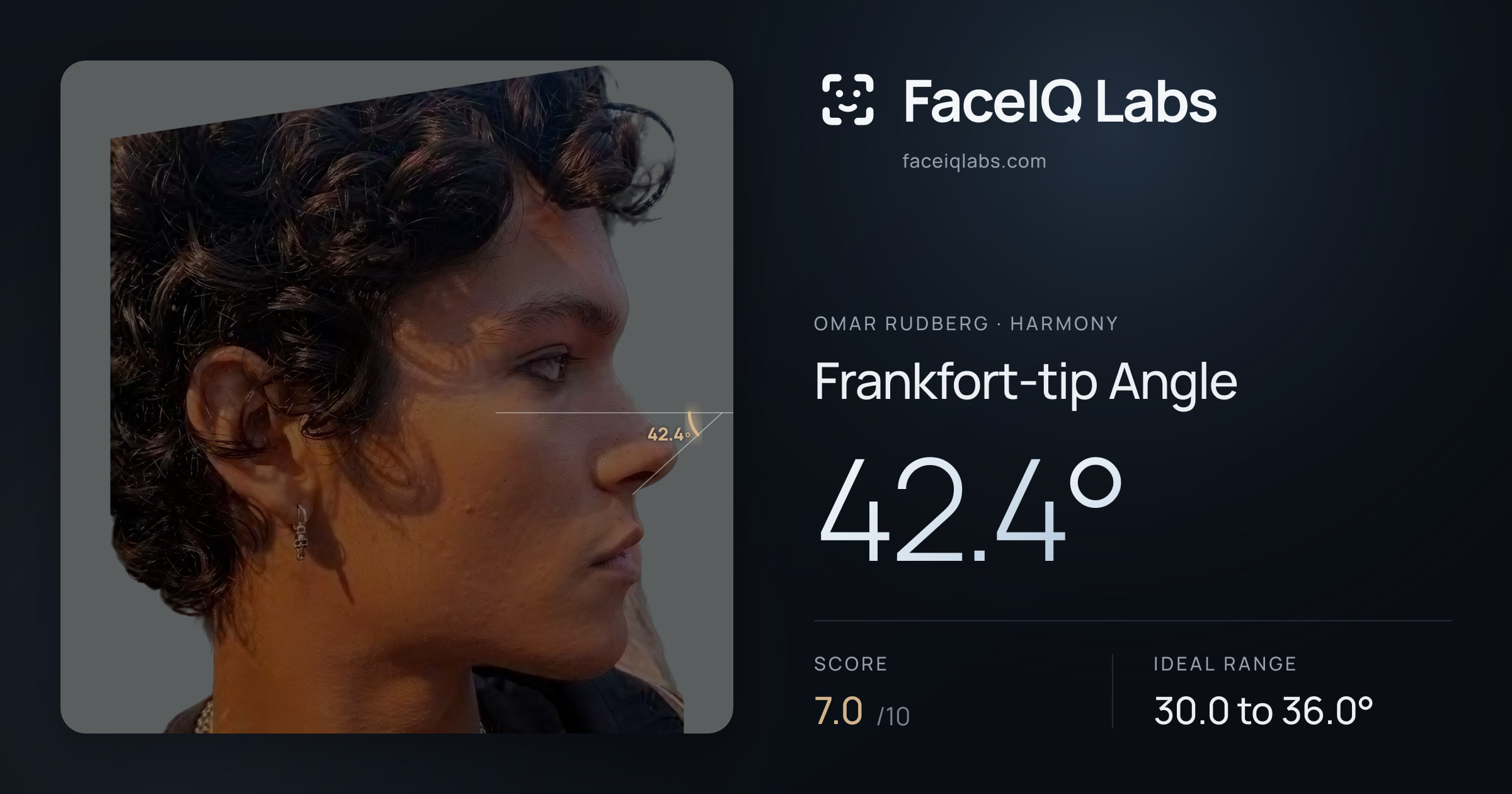 Omar Rudberg Frankfort-tip Angle: 42.4°, drawn on the photo
