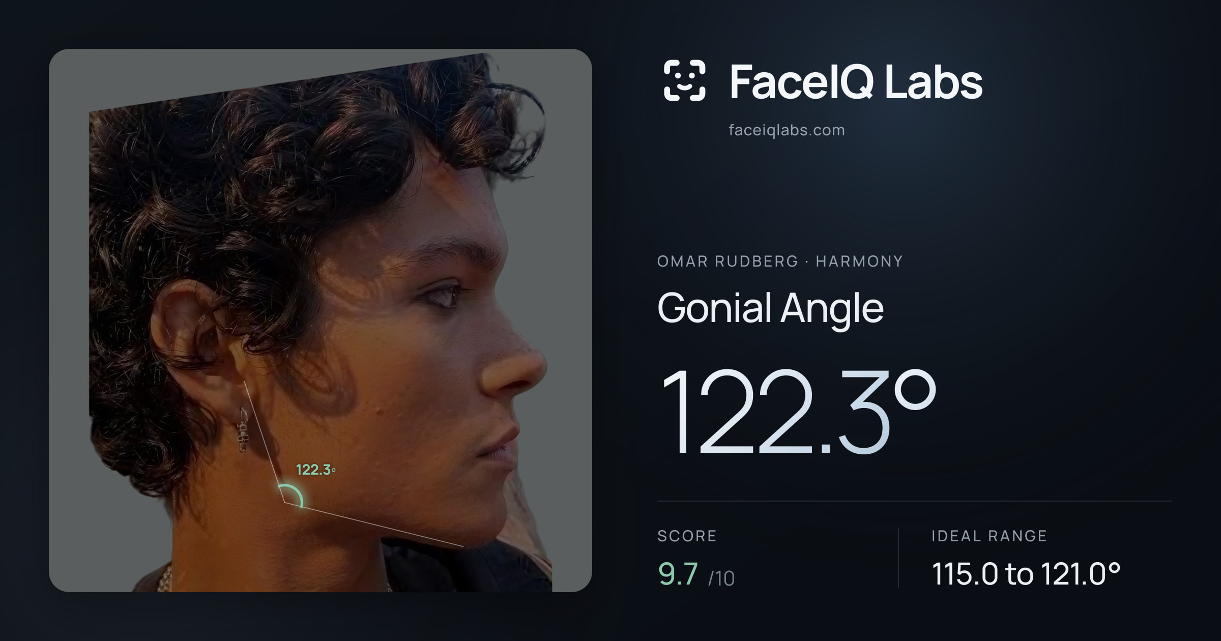 Omar Rudberg Gonial Angle: 122.3°, drawn on the photo