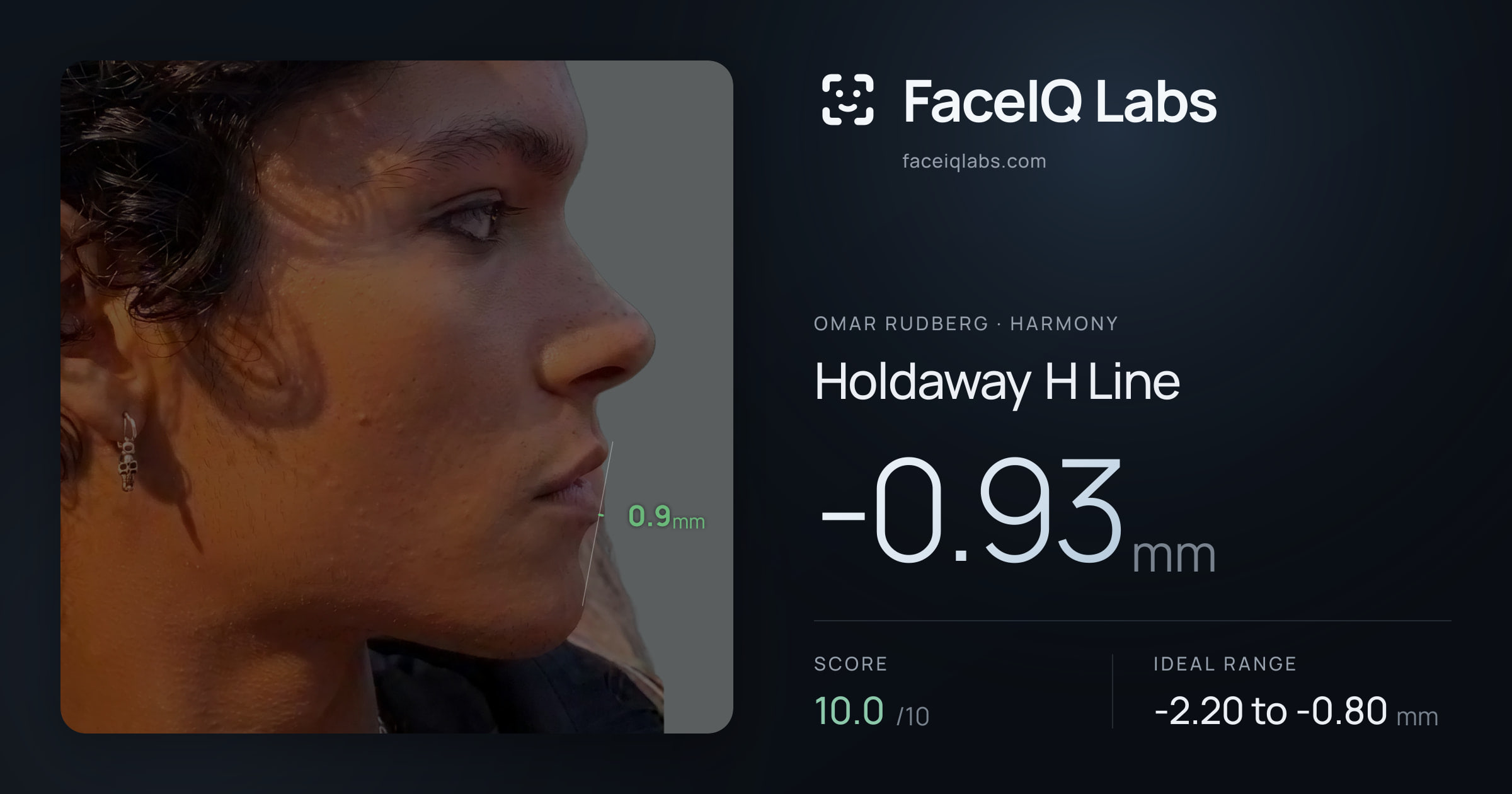 Omar Rudberg Holdaway H Line: -0.93mm, drawn on the photo