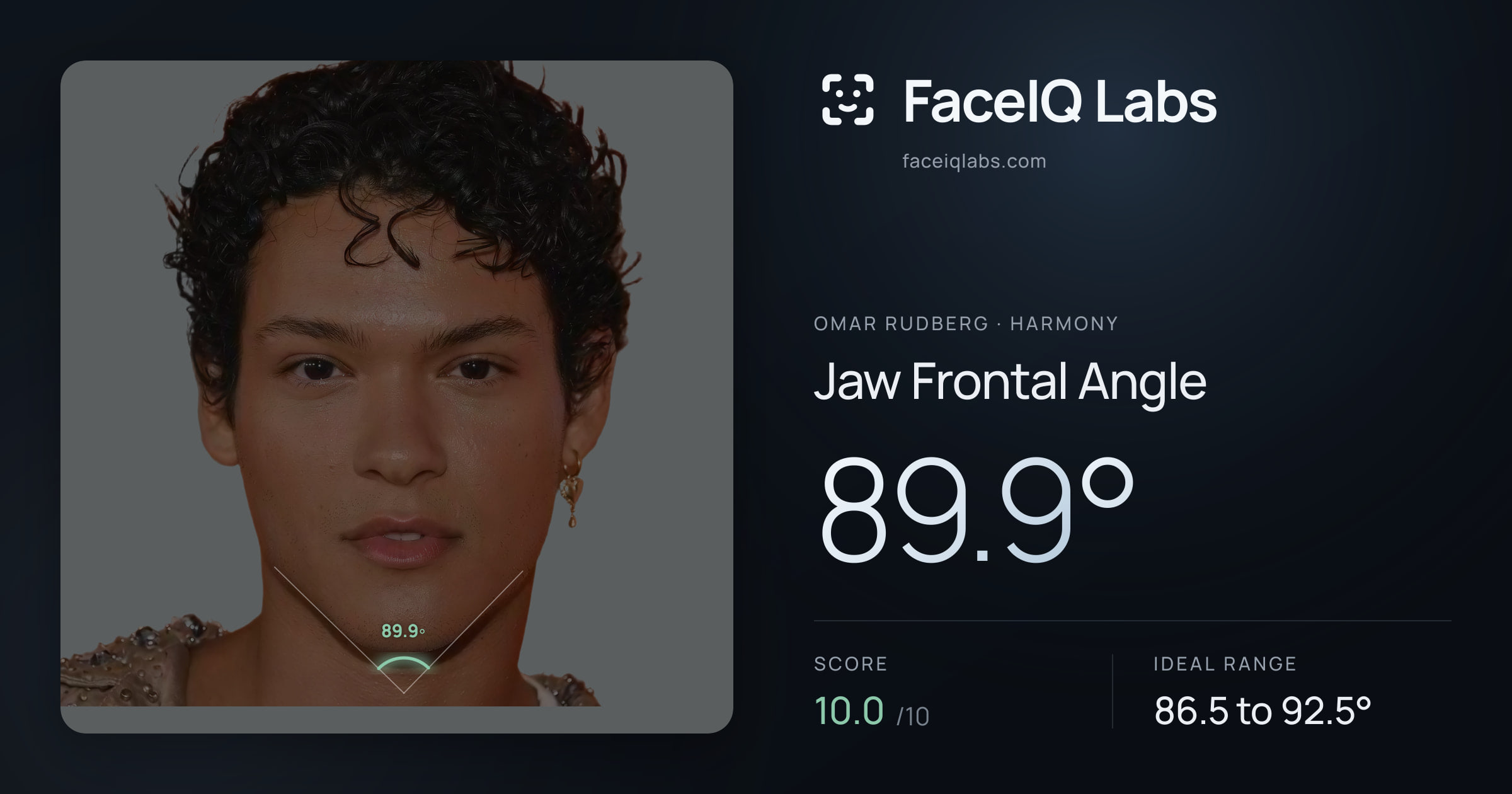 Omar Rudberg Jaw Frontal Angle: 89.9°, drawn on the photo