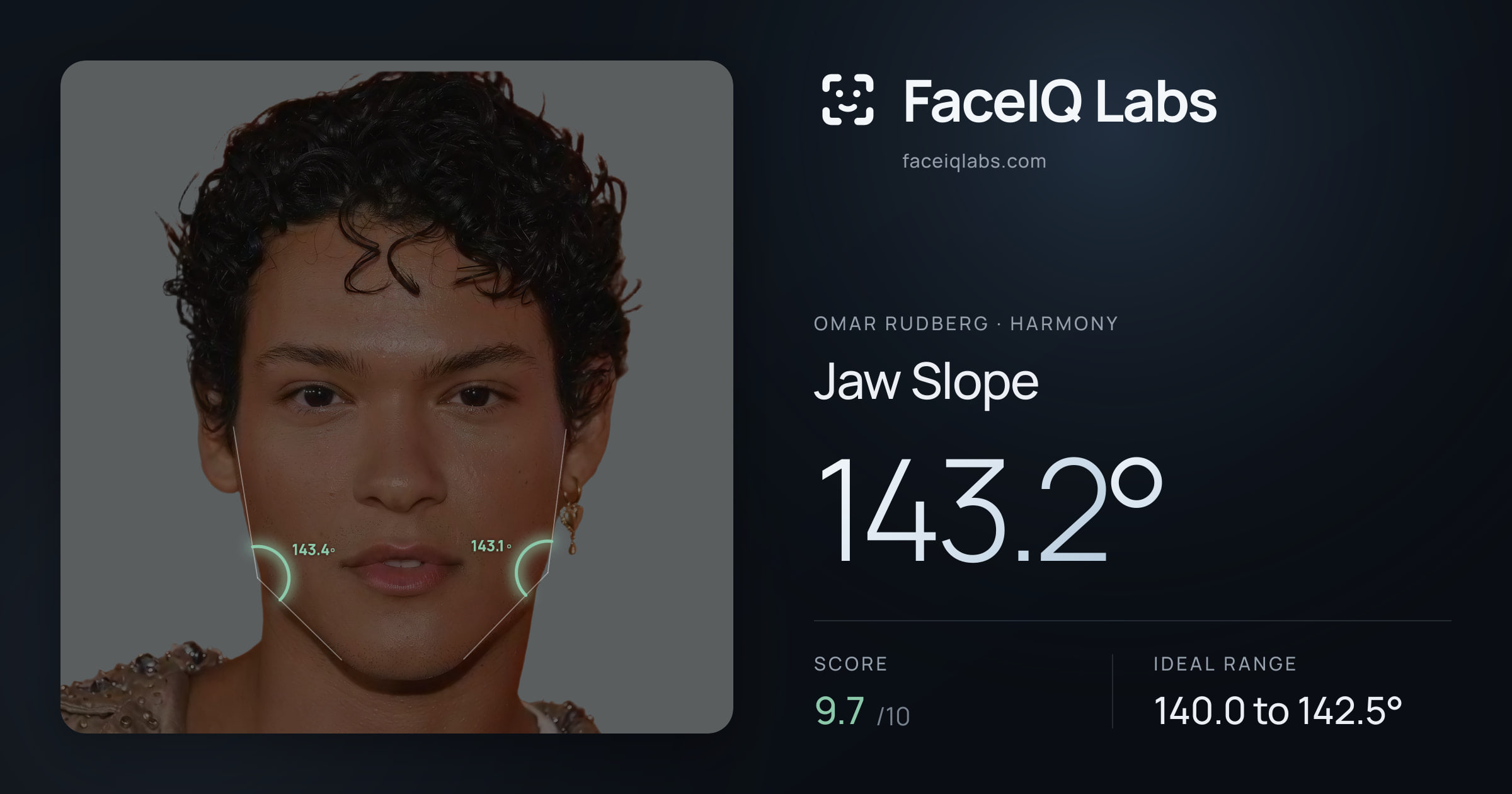 Omar Rudberg Jaw Slope: 143.2°, drawn on the photo