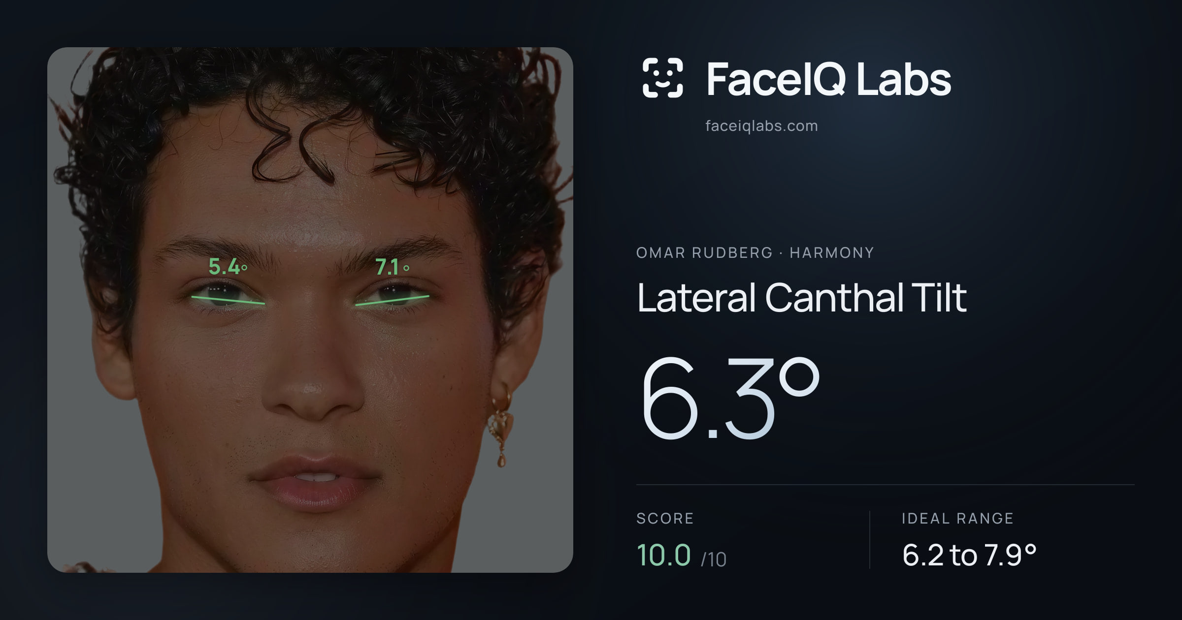 Omar Rudberg Lateral Canthal Tilt: 6.3°, drawn on the photo