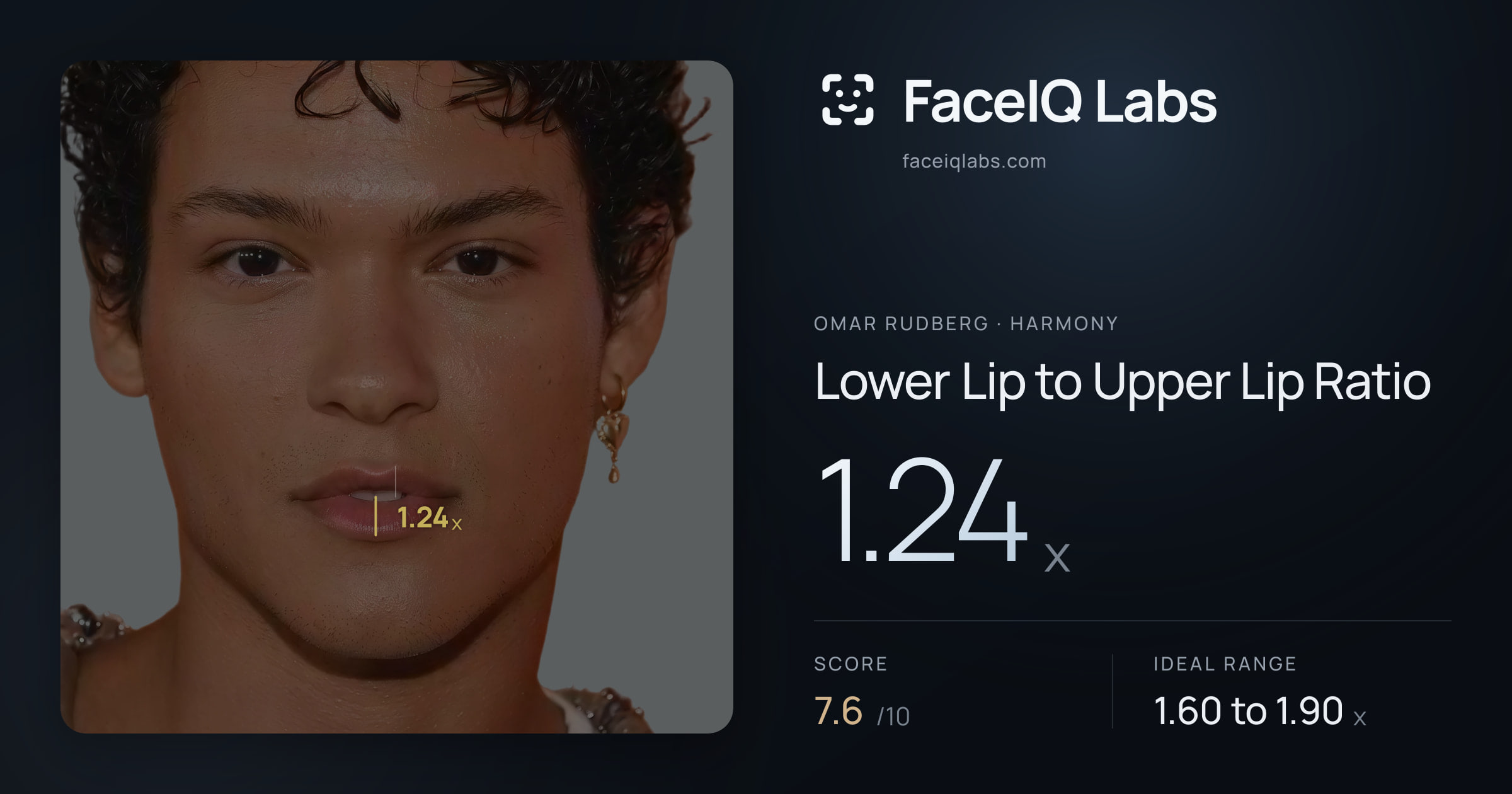 Omar Rudberg Lower Lip to Upper Lip Ratio: 1.24x, drawn on the photo