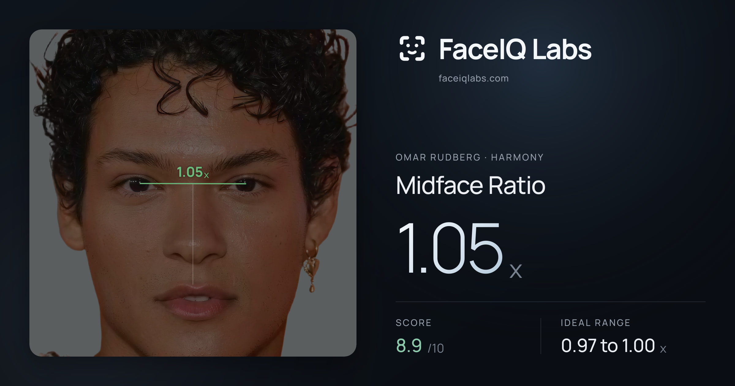 Omar Rudberg Midface Ratio: 1.05x, drawn on the photo