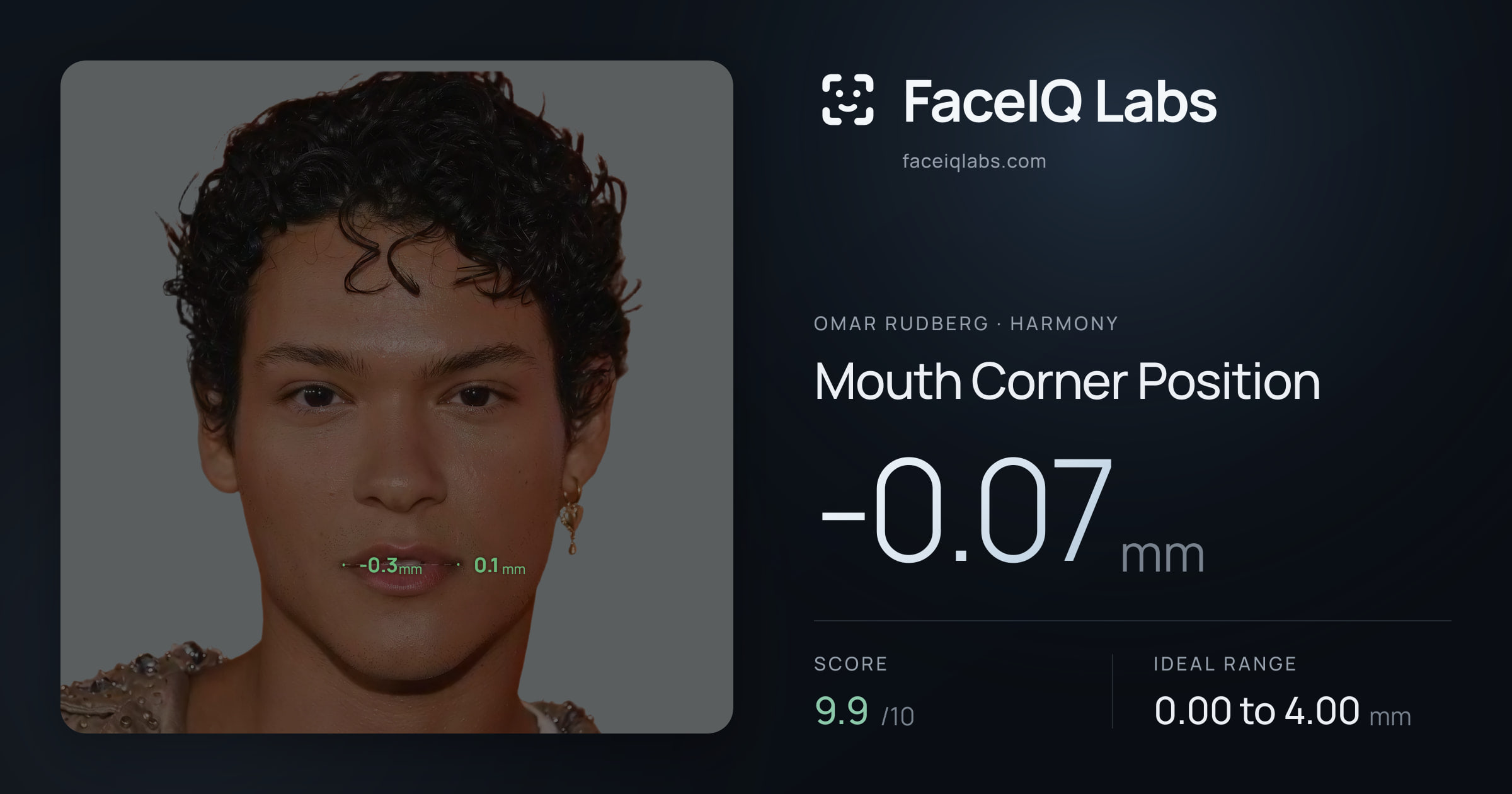 Omar Rudberg Mouth Corner Position: -0.07mm, drawn on the photo