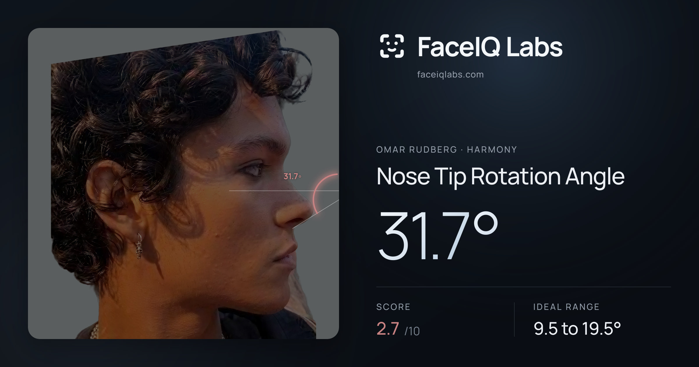 Omar Rudberg Nose Tip Rotation Angle: 31.7°, drawn on the photo