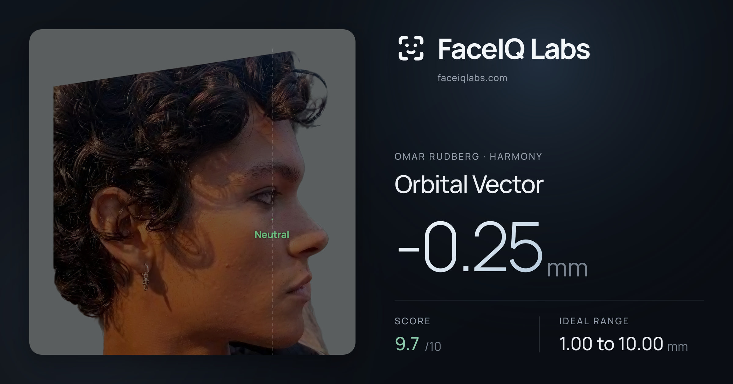 Omar Rudberg Orbital Vector: -0.25mm, drawn on the photo