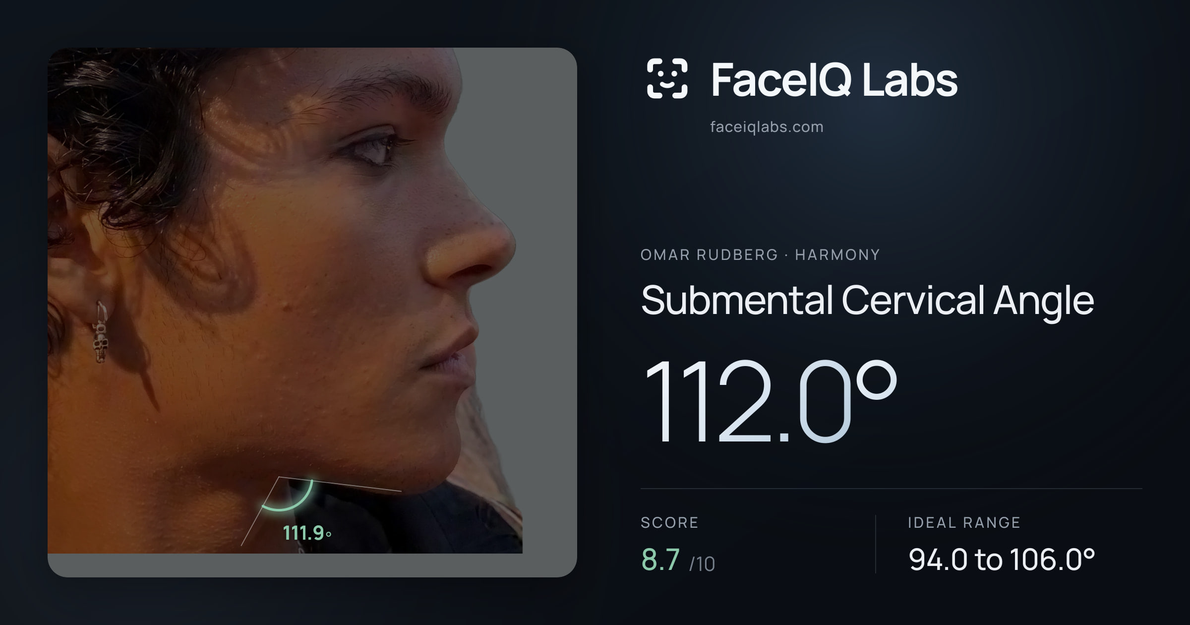 Omar Rudberg Submental Cervical Angle: 112.0°, drawn on the photo