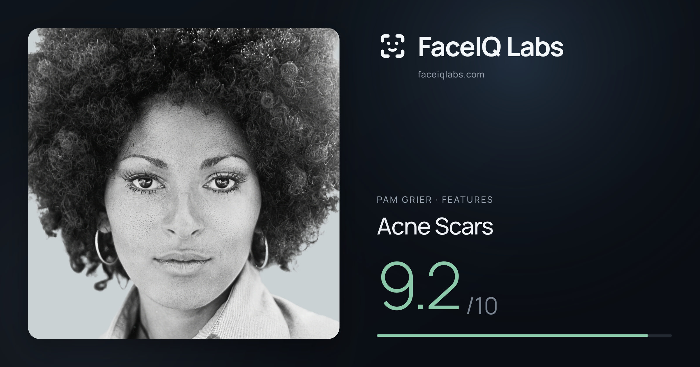 Pam Grier Acne Scars: 9.2/10, drawn on the photo