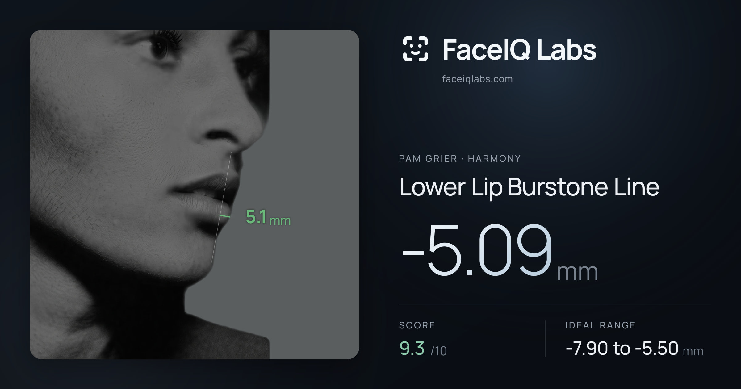 Pam Grier Lower Lip Burstone Line: -5.09mm, drawn on the photo