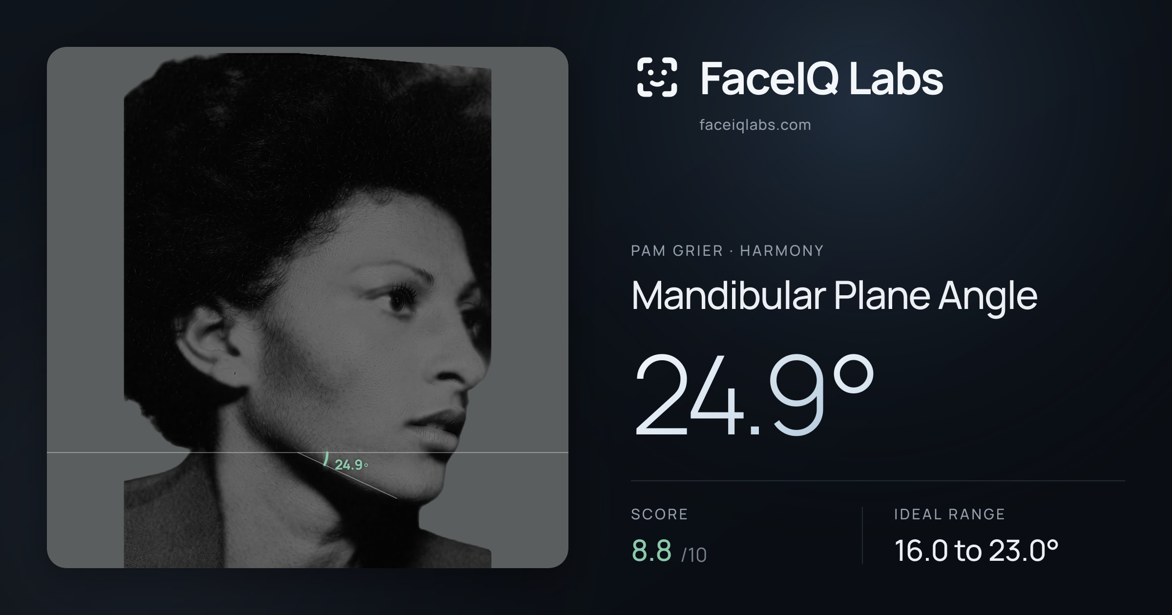 Pam Grier Mandibular Plane Angle: 24.9°, drawn on the photo