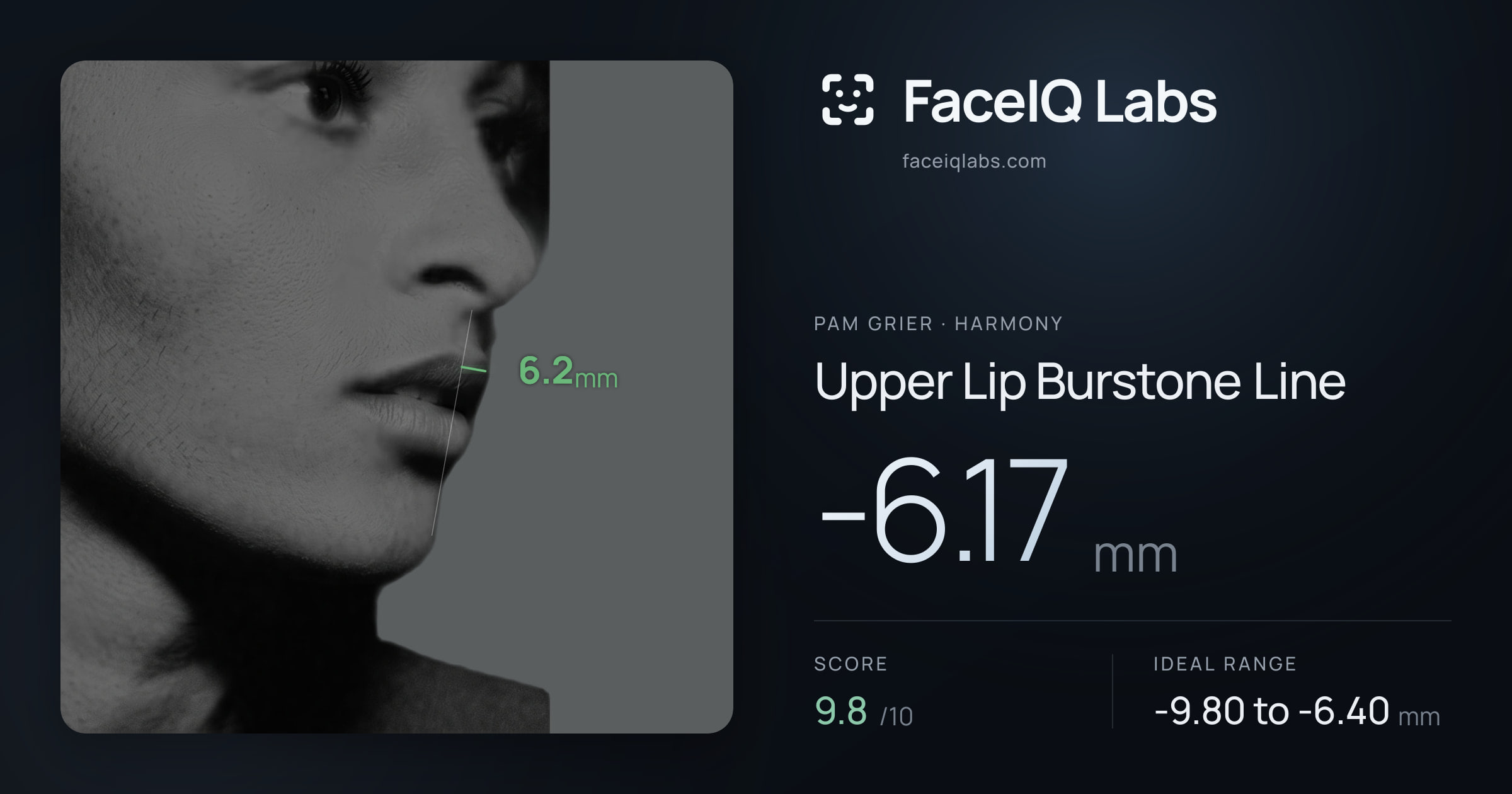 Pam Grier Upper Lip Burstone Line: -6.17mm, drawn on the photo
