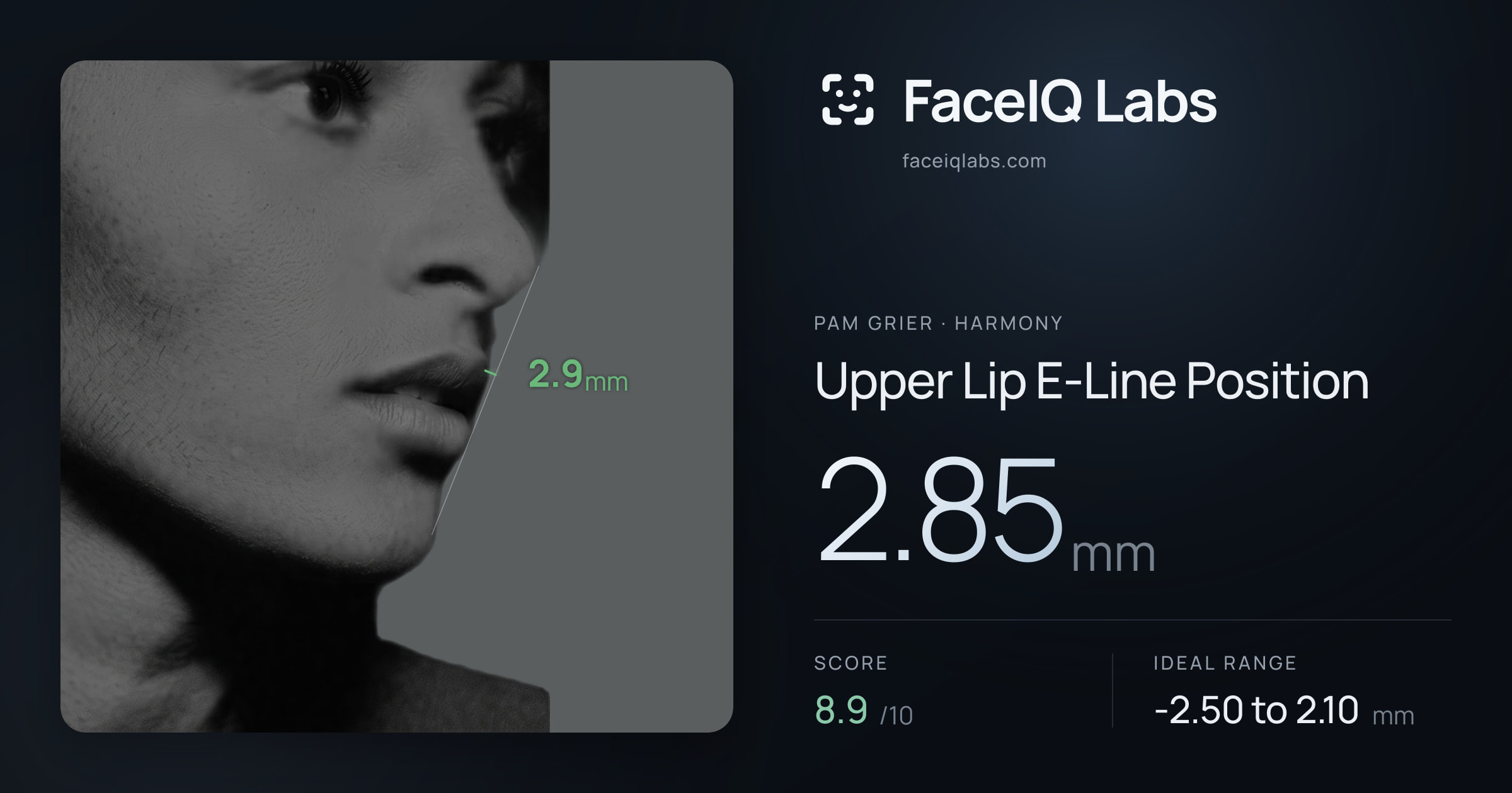 Pam Grier Upper Lip E-Line Position: 2.85mm, drawn on the photo