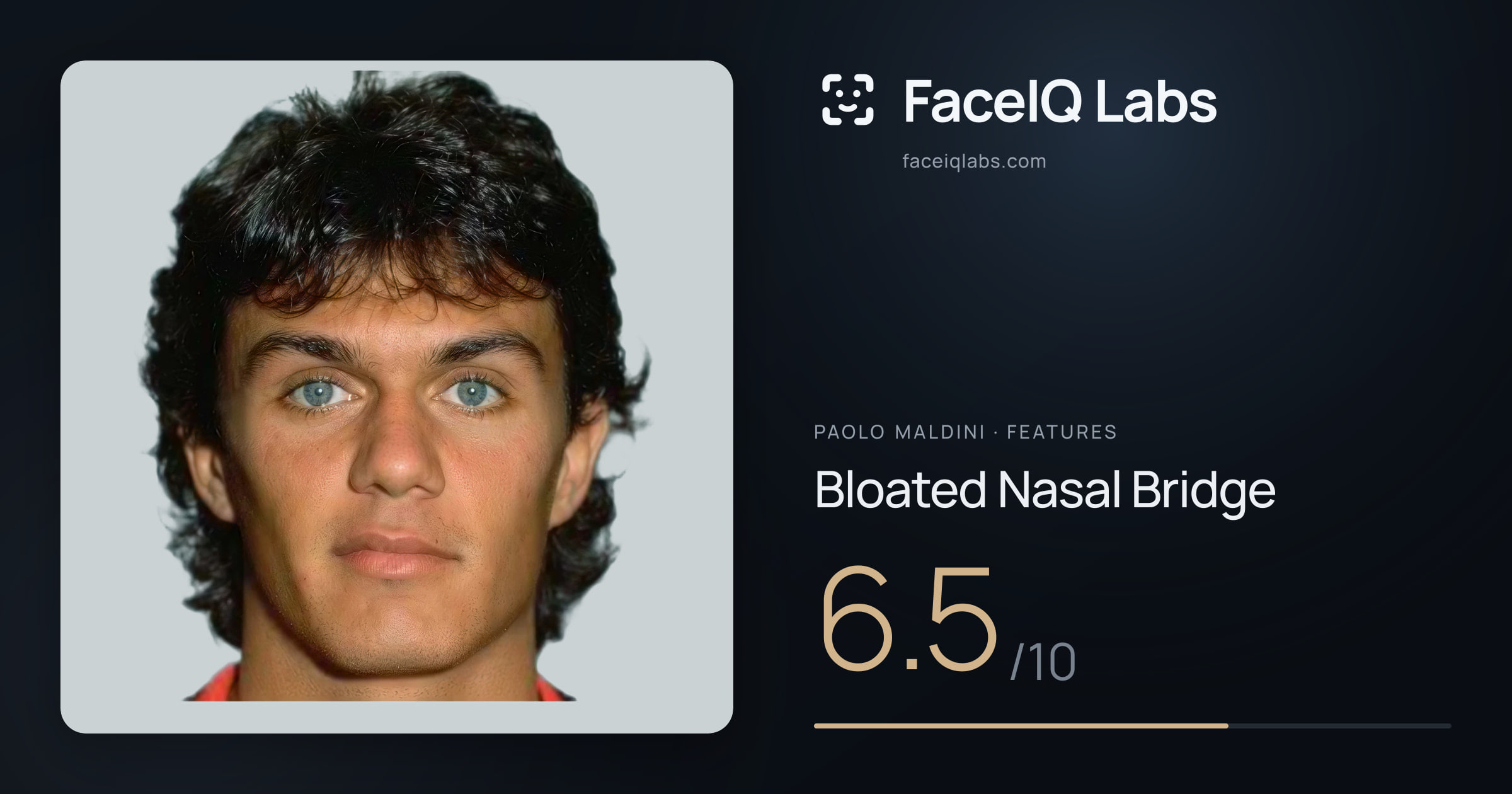 Paolo Maldini Bloated Nasal Bridge: 6.5/10, drawn on the photo