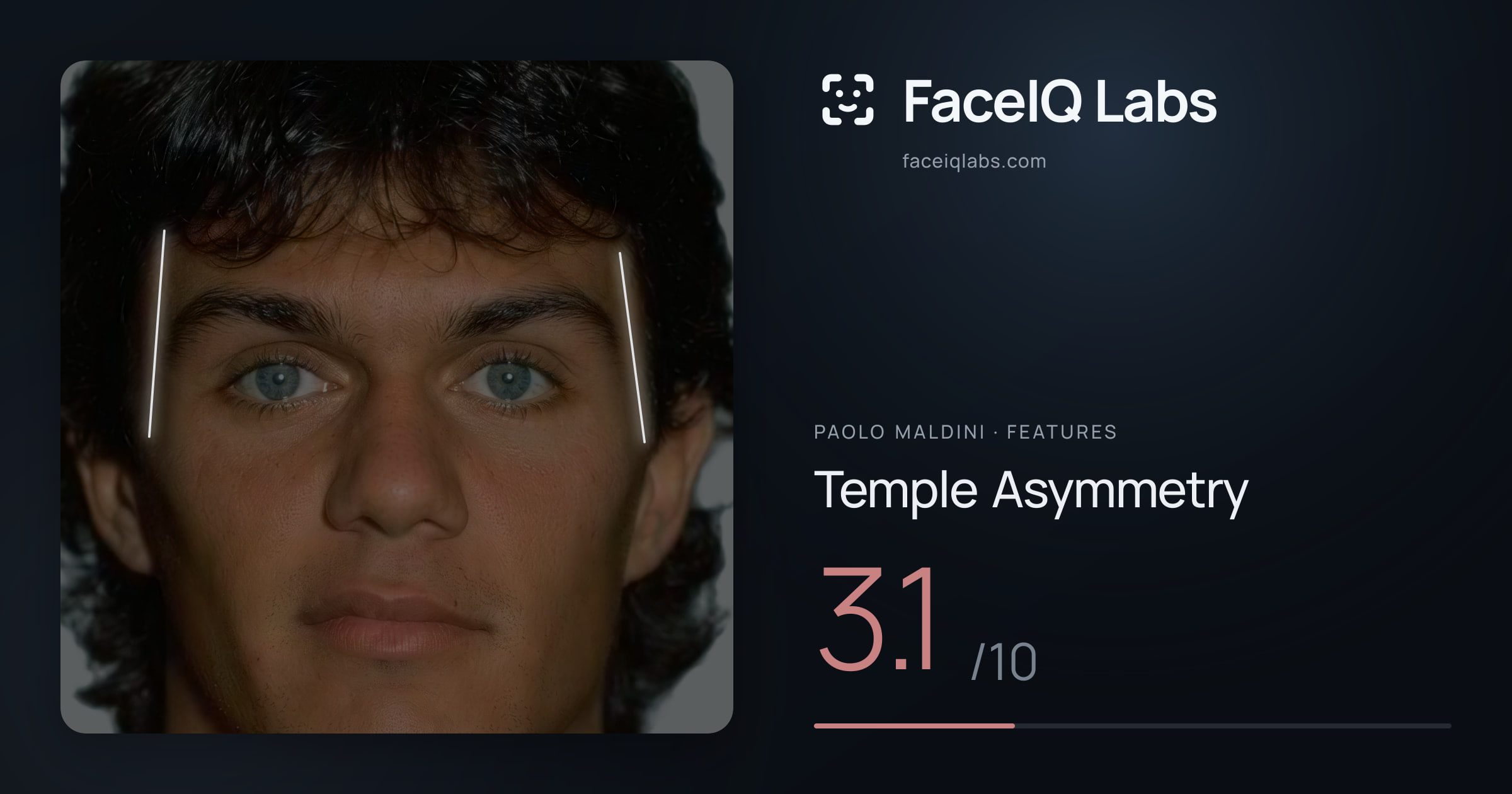 Paolo Maldini Temple Asymmetry: 3.1/10, drawn on the photo